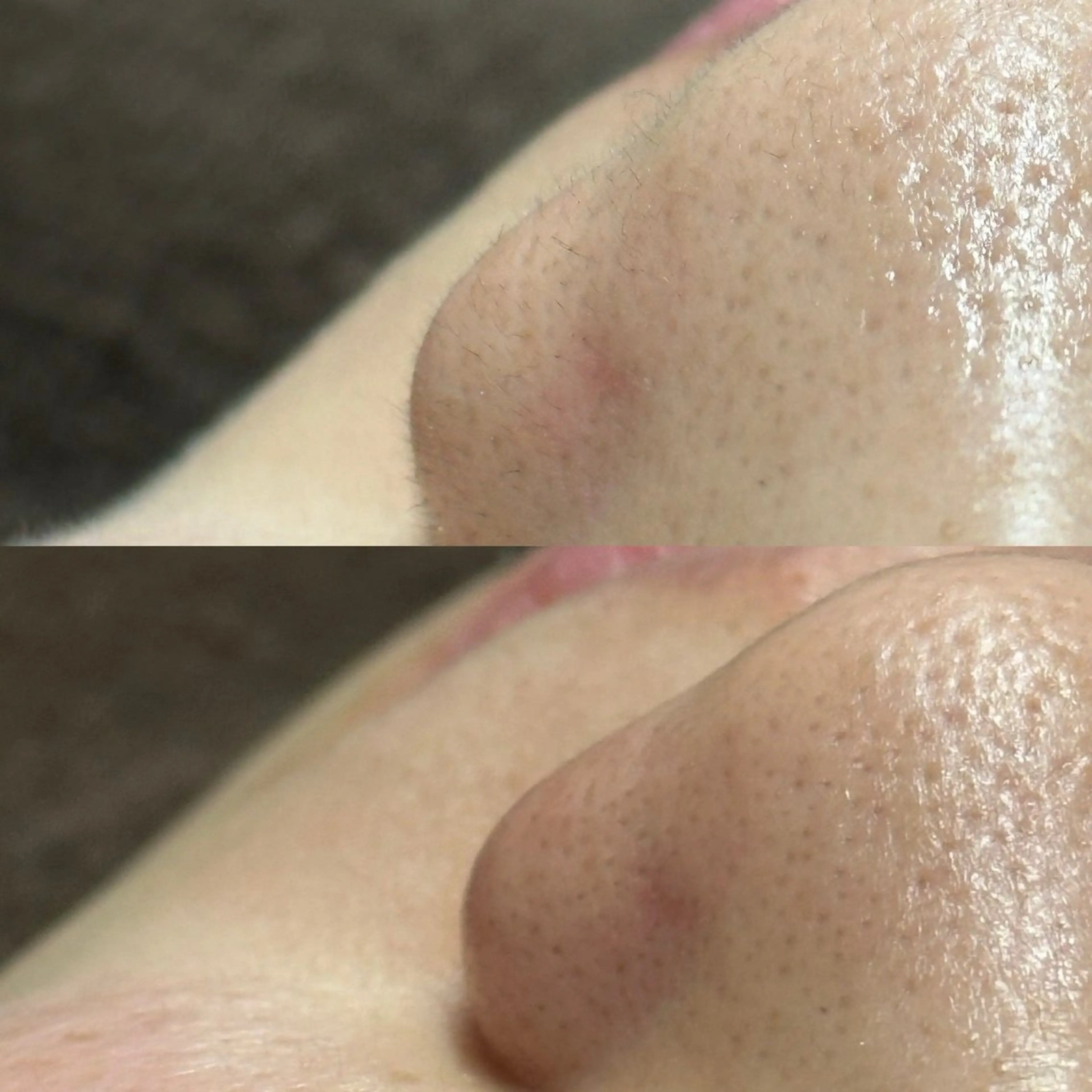 脱毛 LAKI eye&face  studio所属・LAKI studioのエステ・リラクイメージ