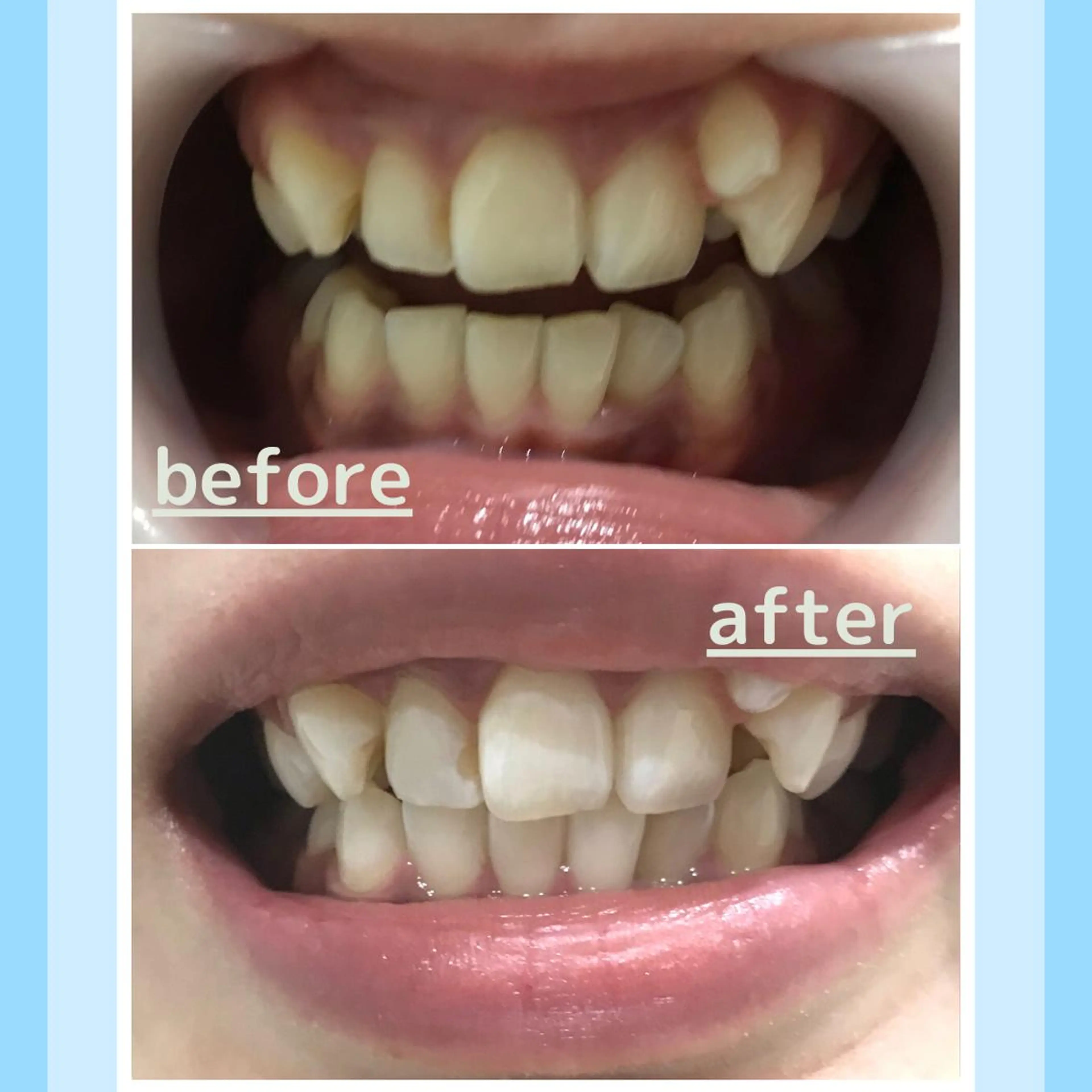 メンズ お手軽ホワイトニングsalon mina所属・武元 奈津美のその他イメージ