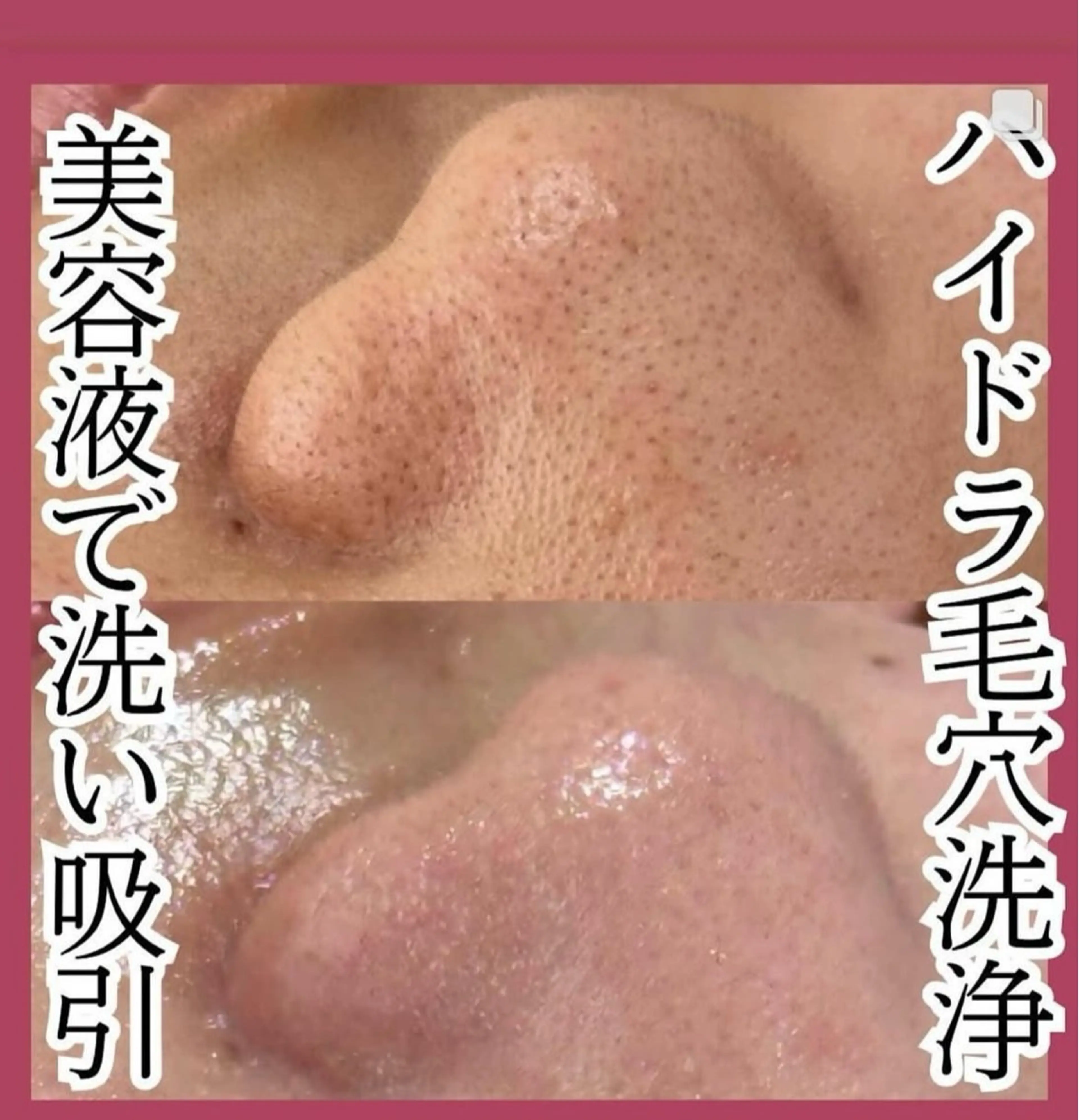 🦋肌改善 laule'a🦋のエステ・リラクイメージ