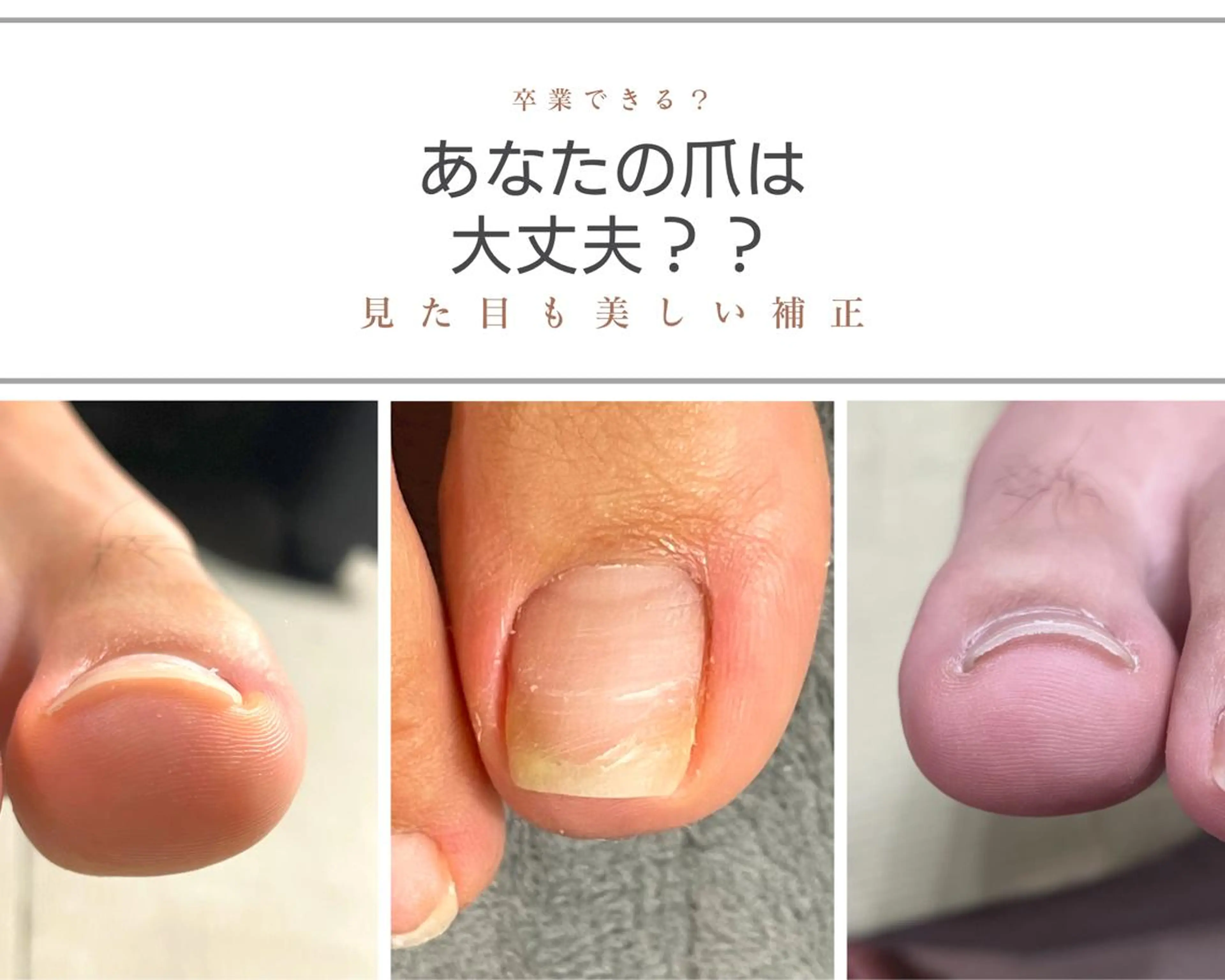 ネイル Chérinail 爪のお手入れのネイルデザイン