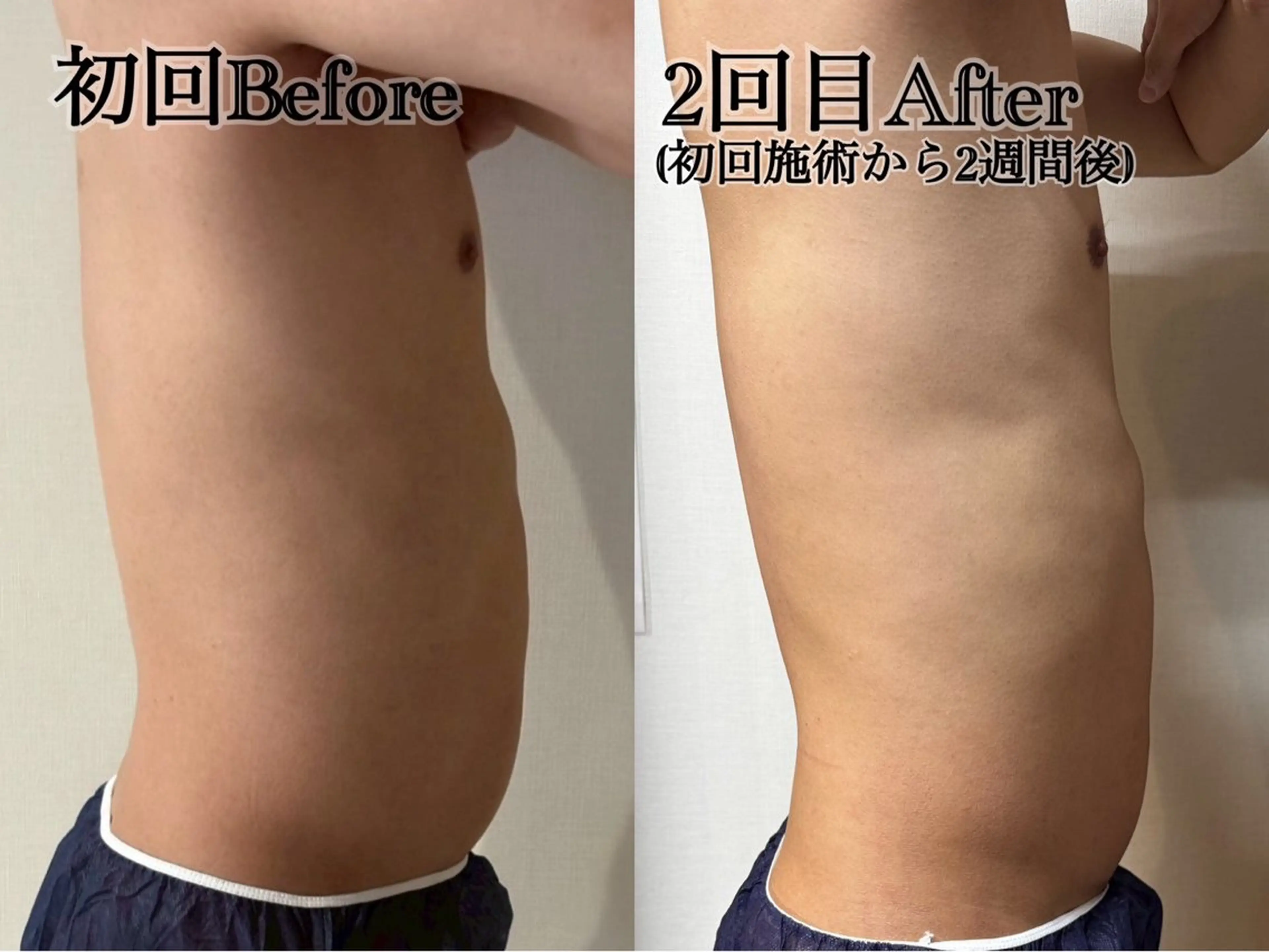 メンズ エステ 六本木/似合わせ眉毛 andＳ🍀Yuriのエステ・リラクイメージ