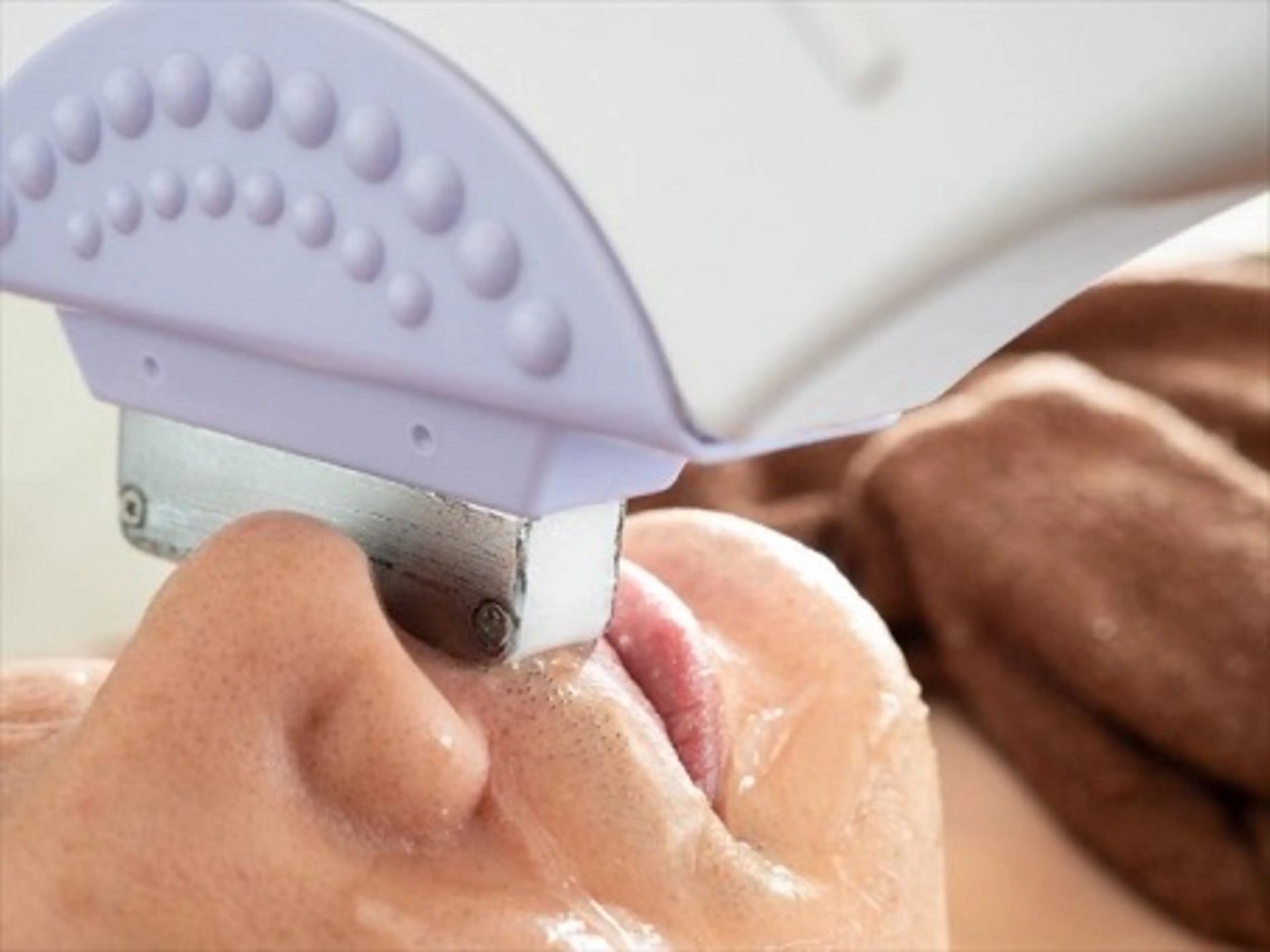 女性顔脱毛の写真