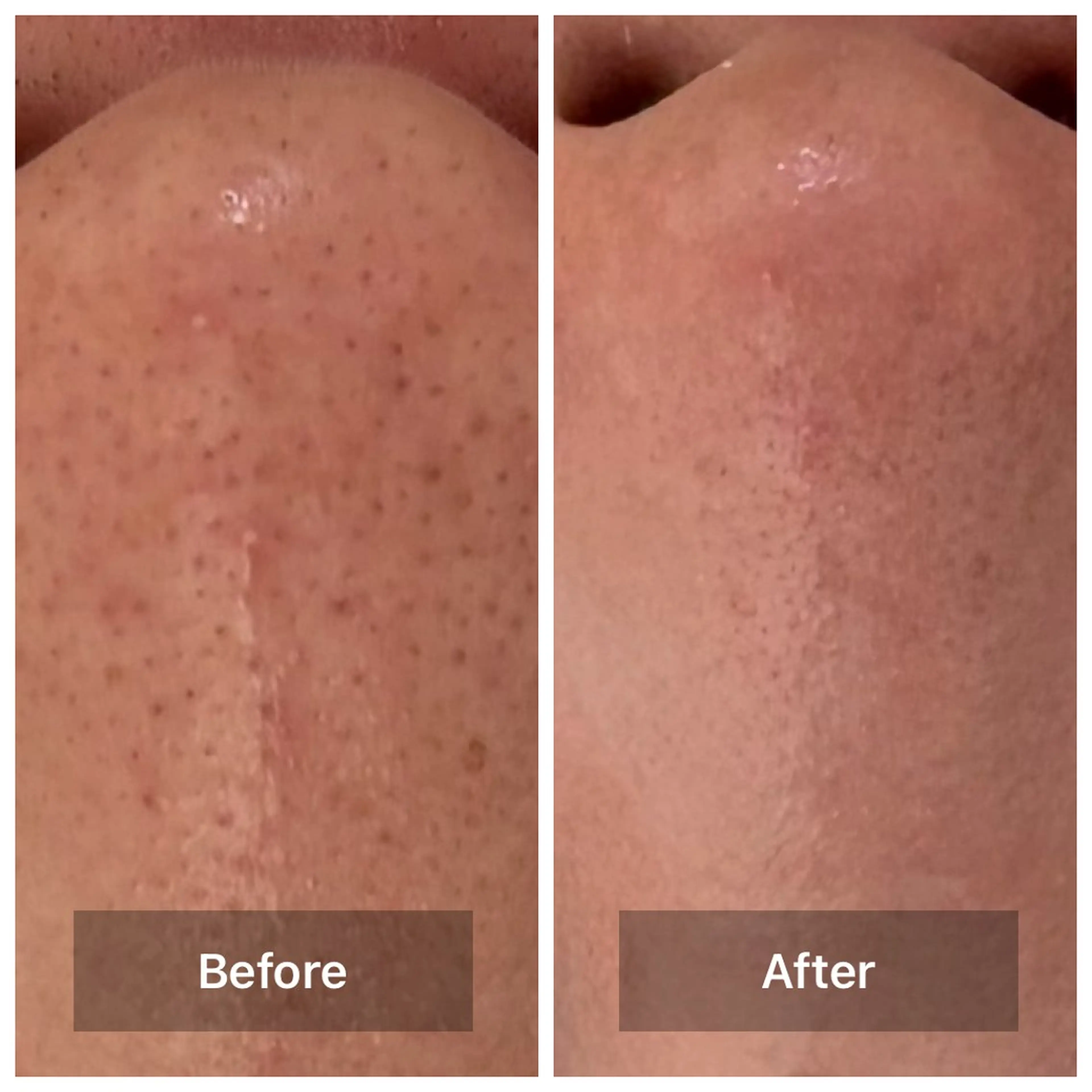 エステ bonuru salonのエステ・リラクイメージ