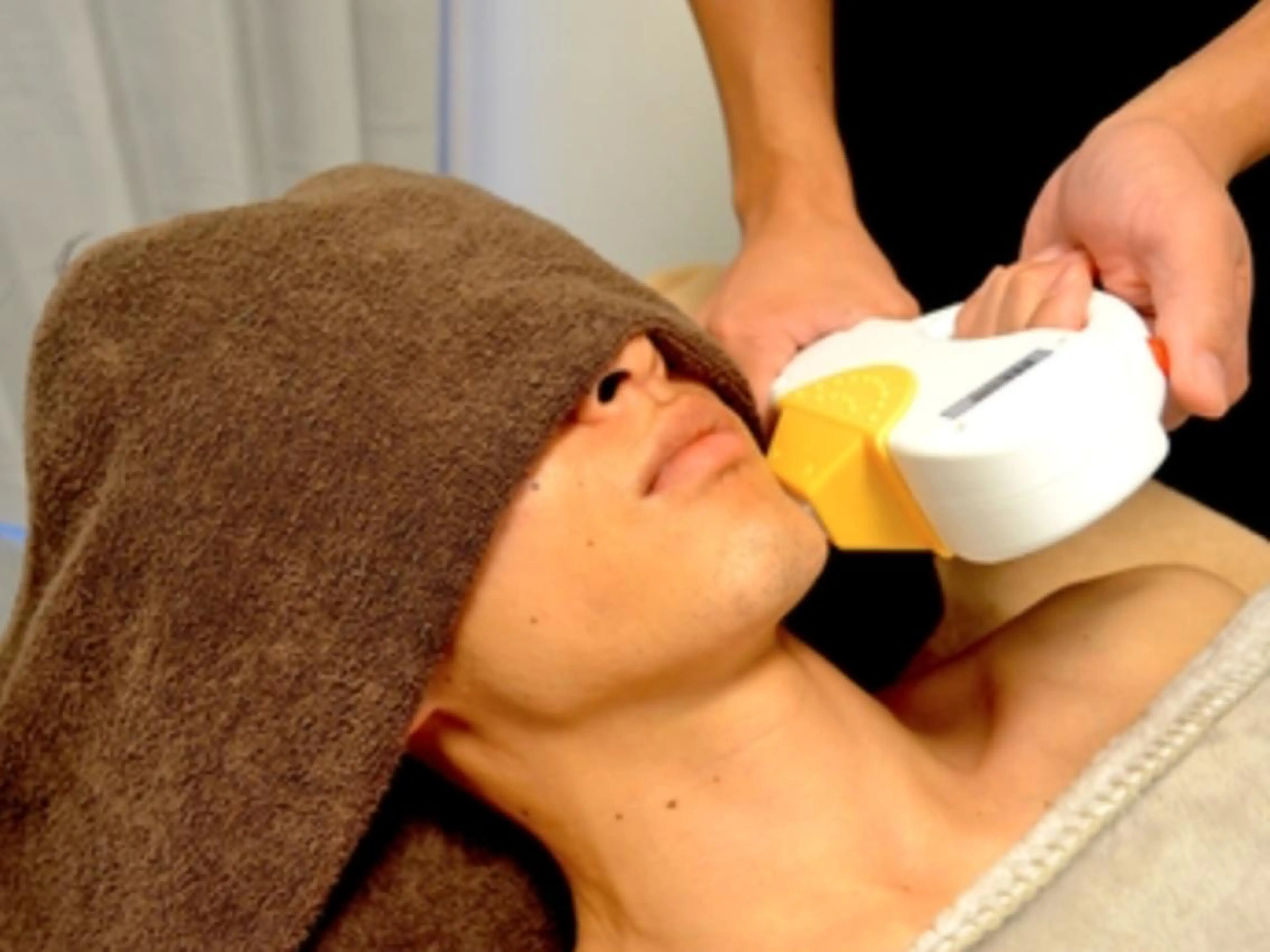 【初回限定】スピード脱毛 顔1回¥8,250→¥1,650の写真