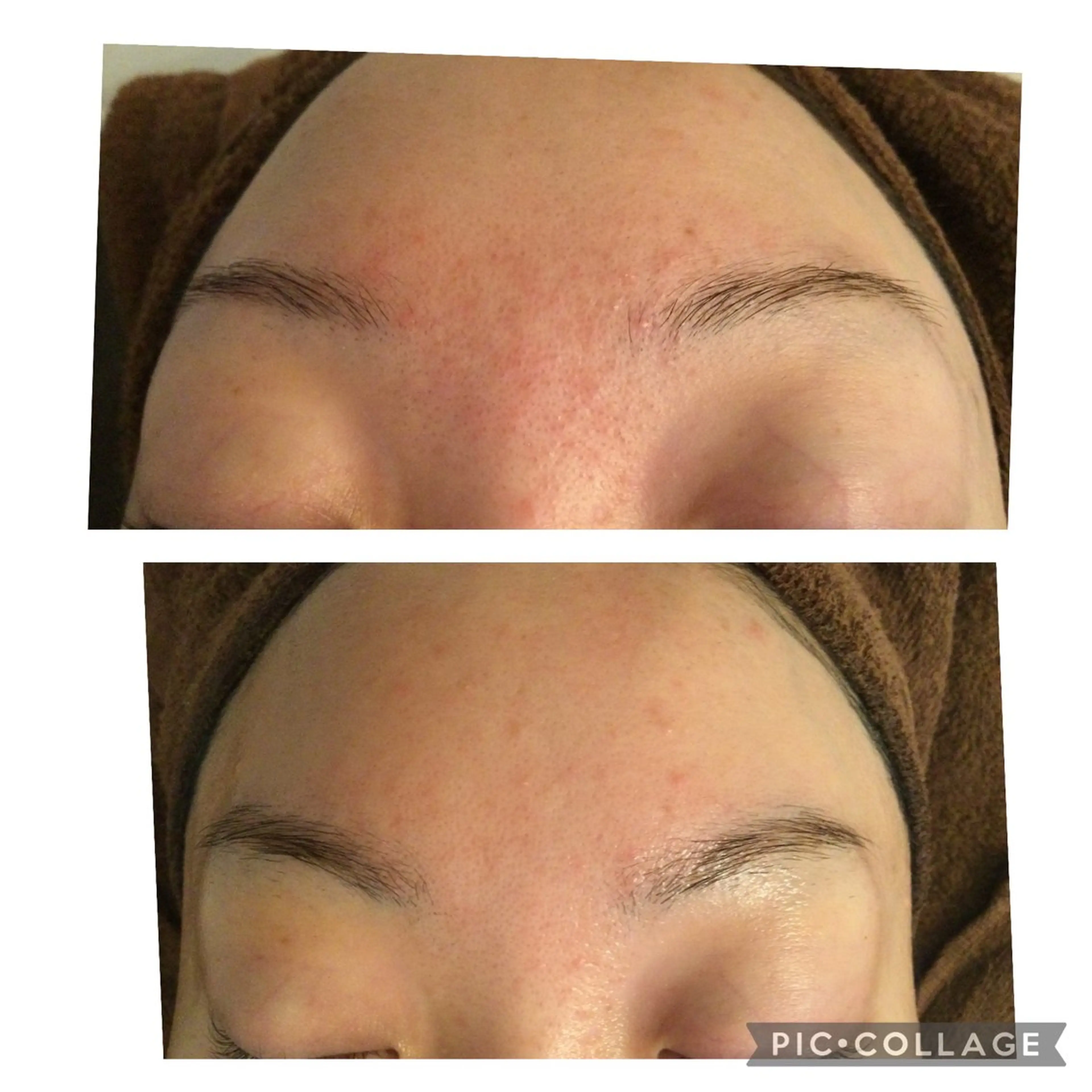 エステ リラク ニキビ/肌質改善専門 Snow skinのエステ・リラクイメージ