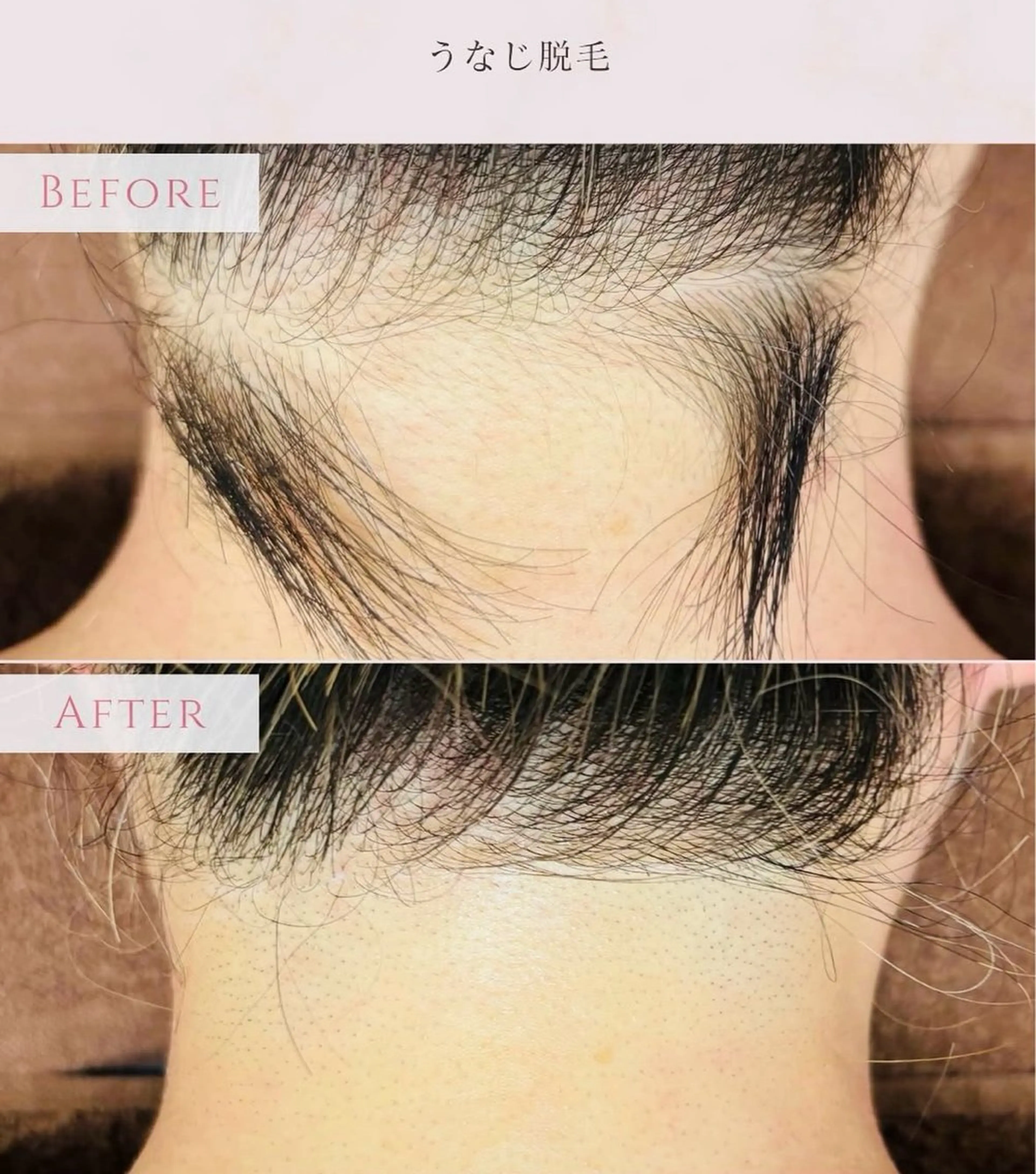 脱毛 女性専用 Lily新原のエステ・リラクイメージ