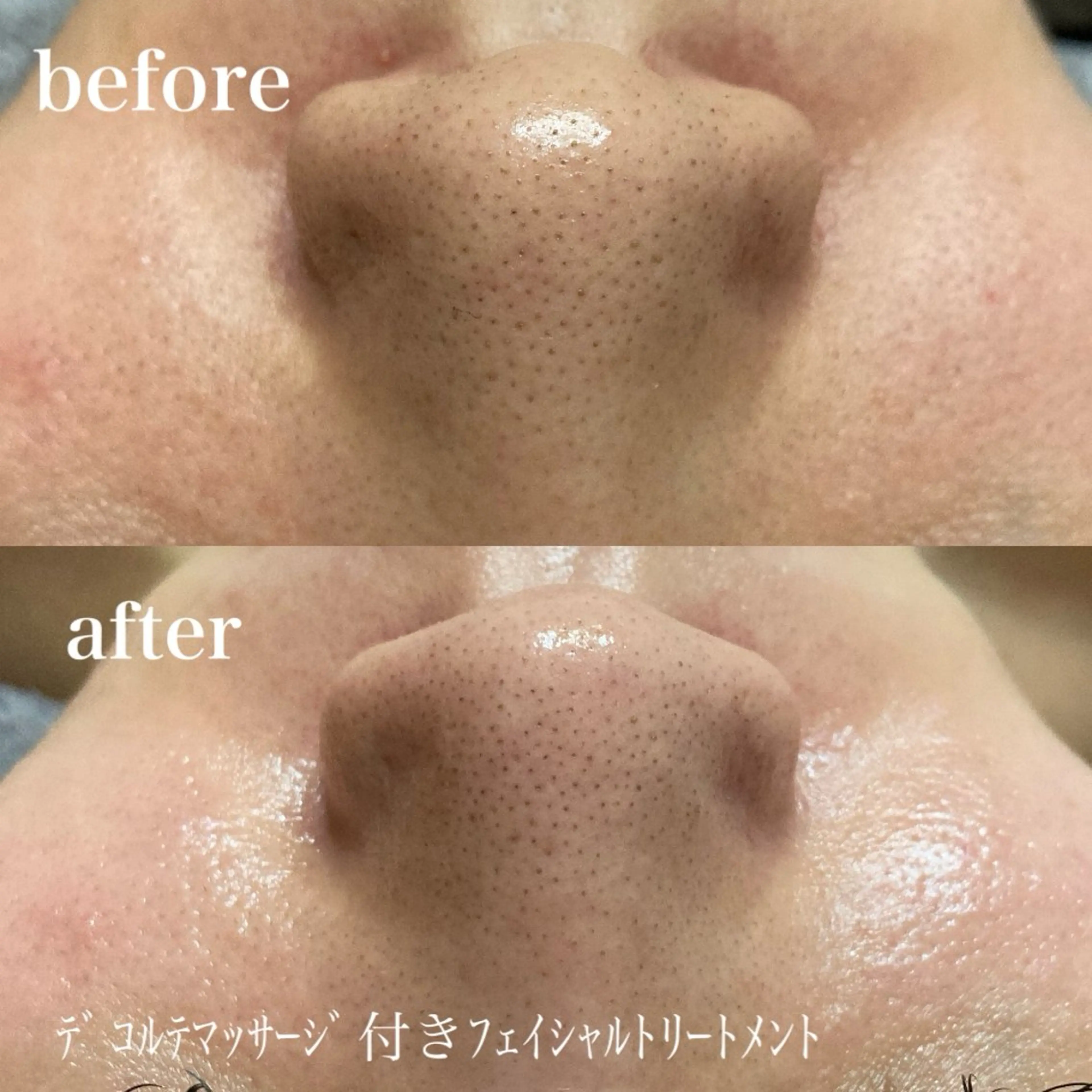 磐田｜LAYLA 一番丁寧な脱毛店のエステ・リラクイメージ