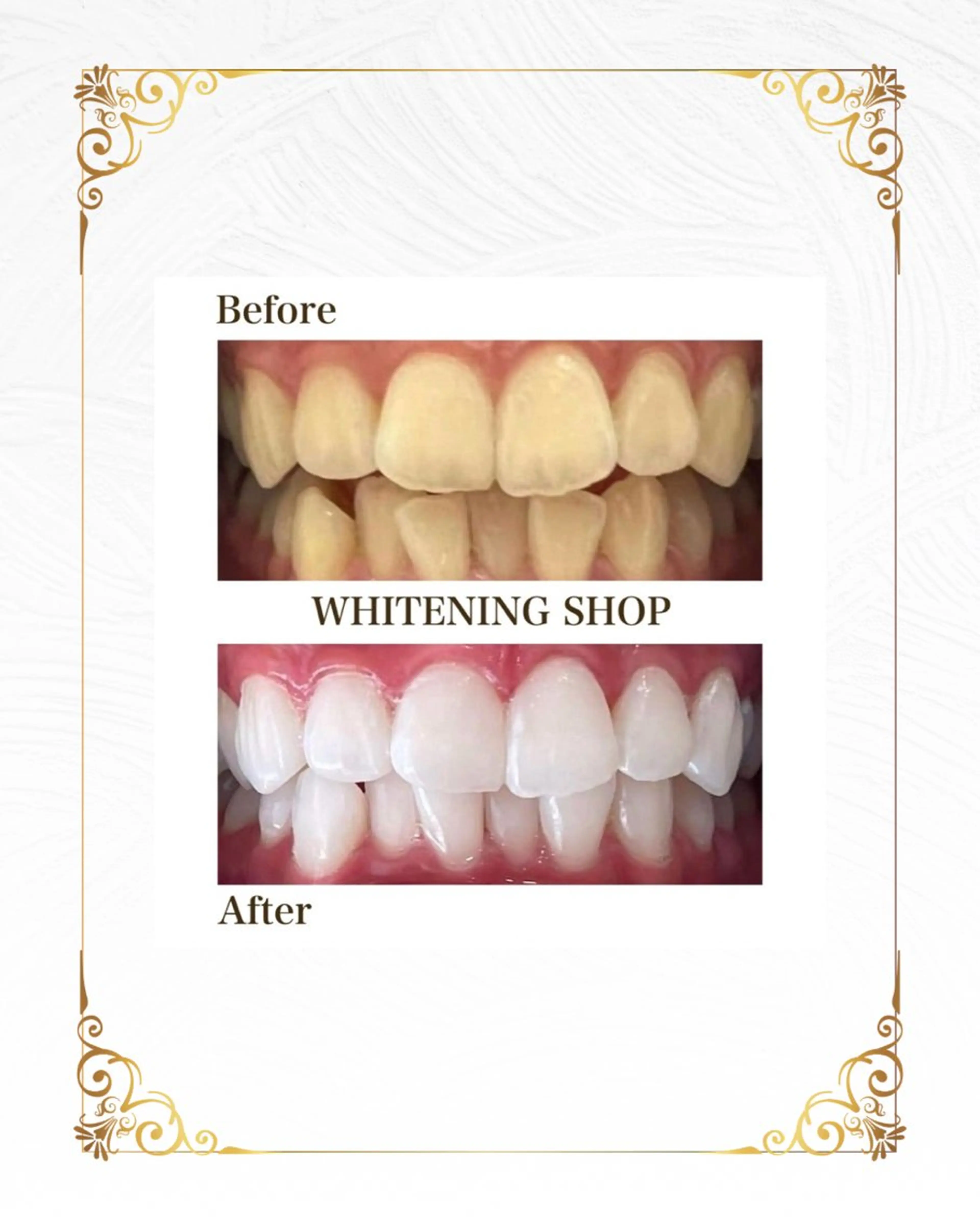 ホワイトニングショップ静岡葵区店所属・ホワイトニング ショップ葵区静岡駅店のその他イメージ