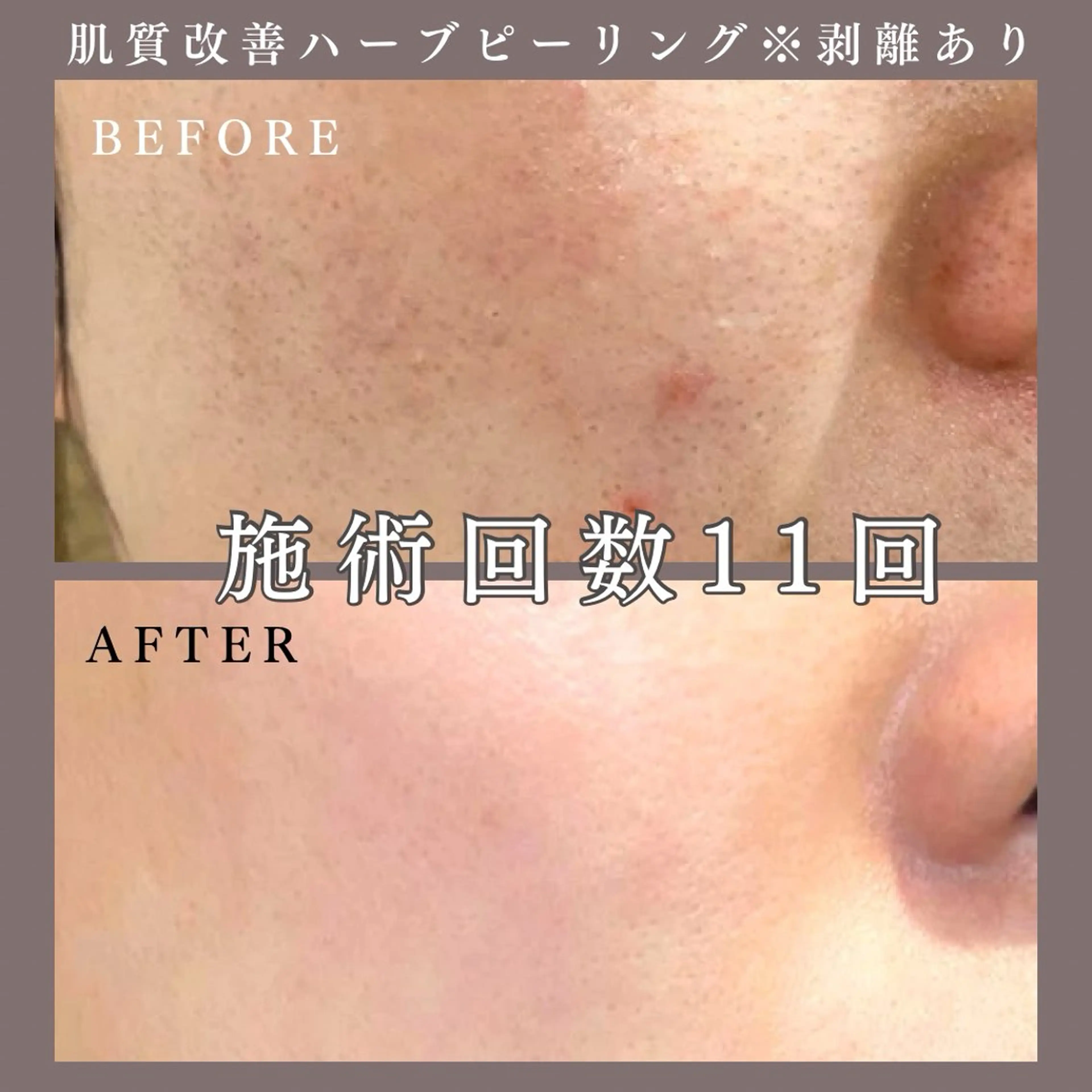 肌質改善専門サロン Bellmi/心斎橋のエステ・リラクイメージ