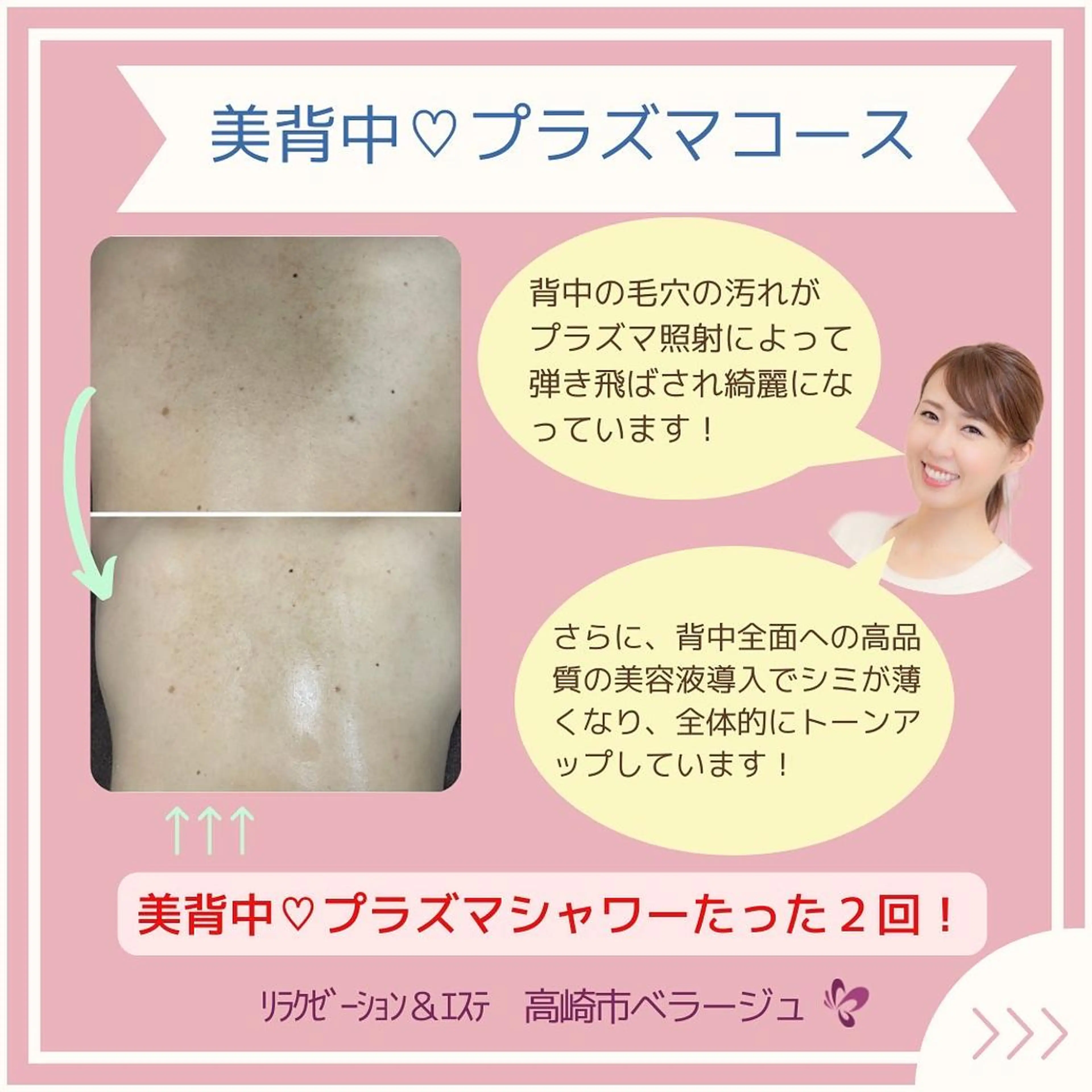 ベラージュ【美背中・ 美尻・フェイシャル】のエステ・リラクイメージ