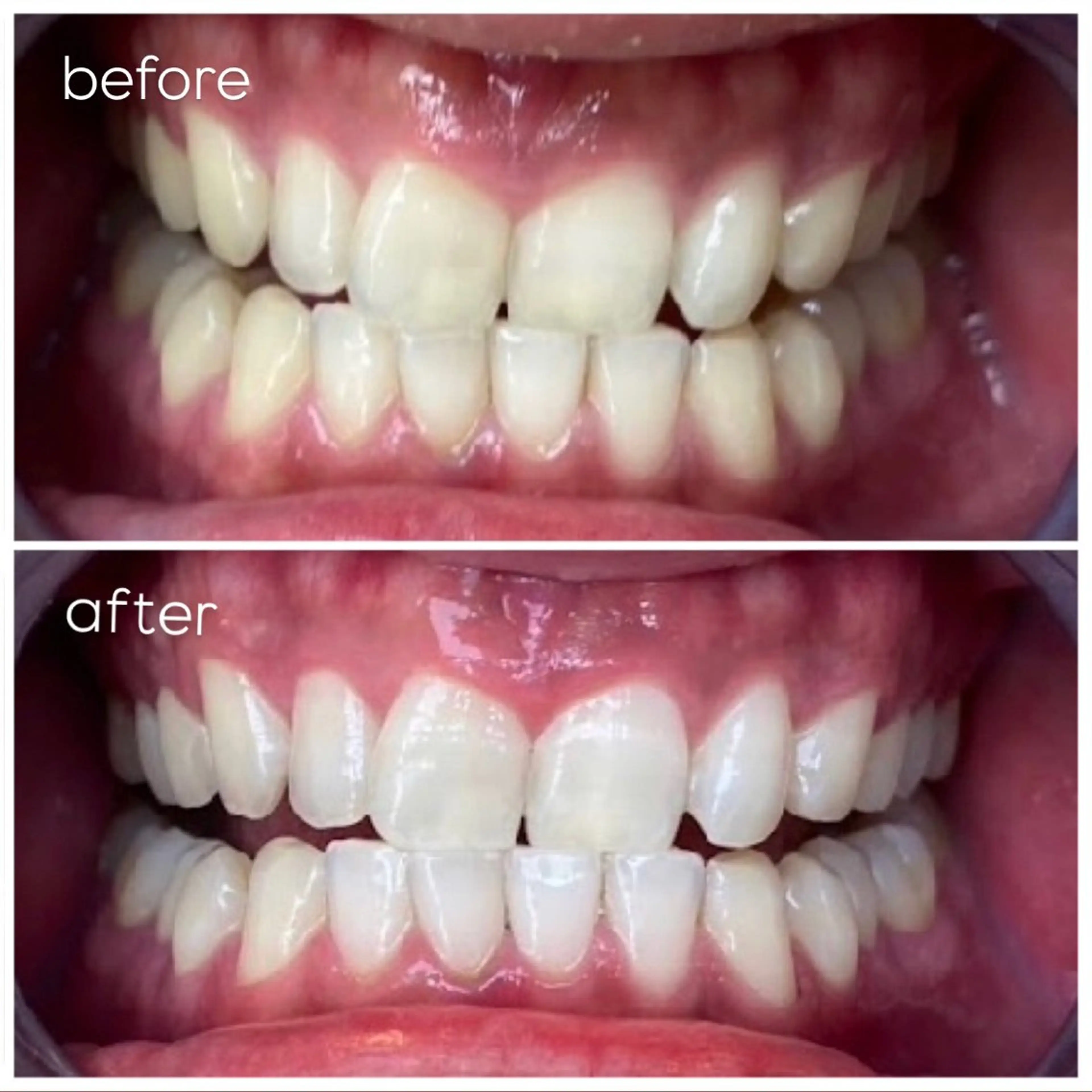 エクシア津駅前店所属・セルフホワイトニング エクシア津駅前店のその他イメージ