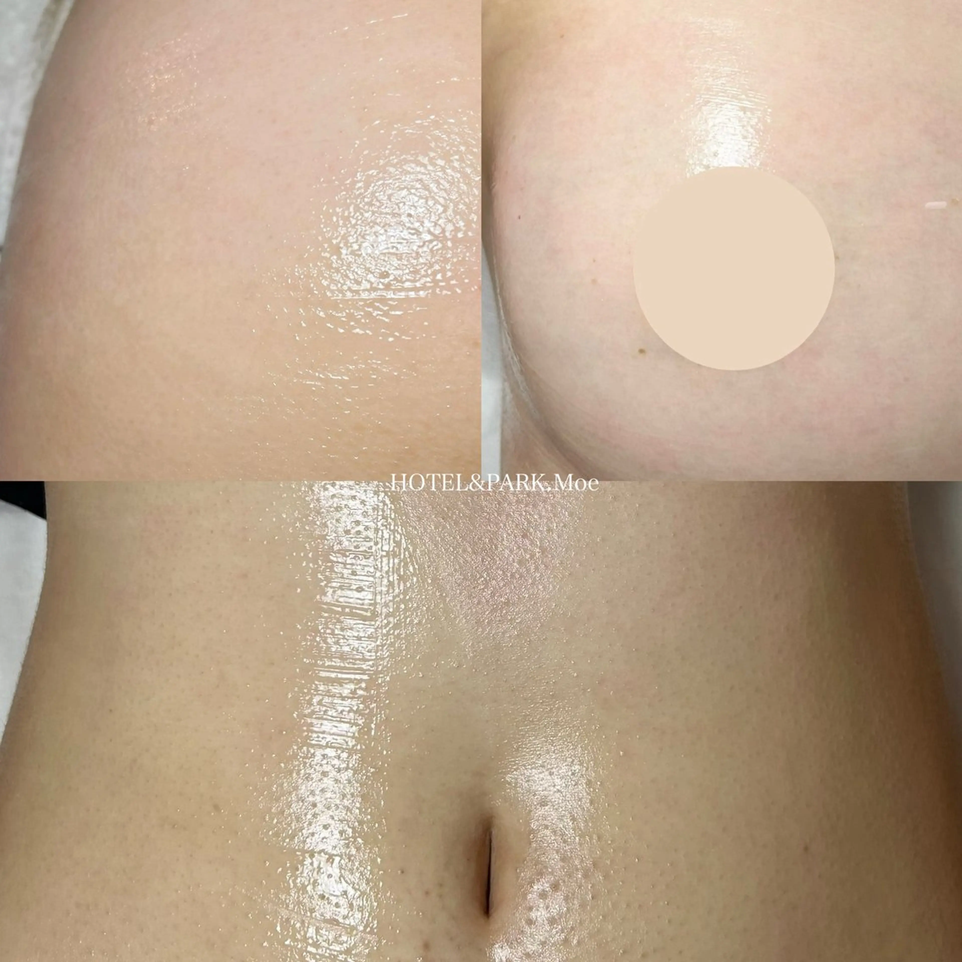 ☃️BIG SALE☃️【VIO+(お尻orお腹orお胸)ワックス脱毛】の写真