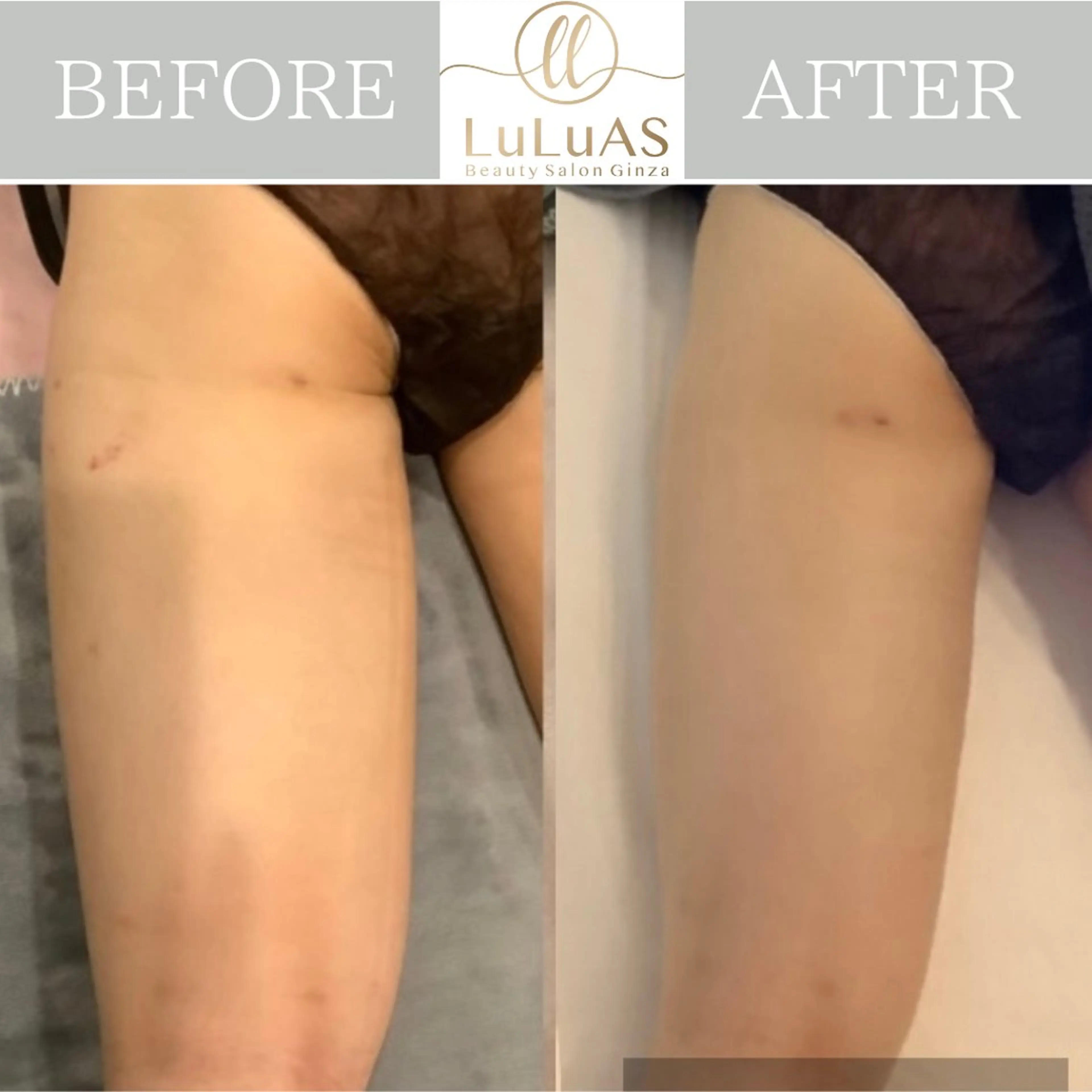 エステ リラク ルルアス GINZAのエステ・リラクイメージ