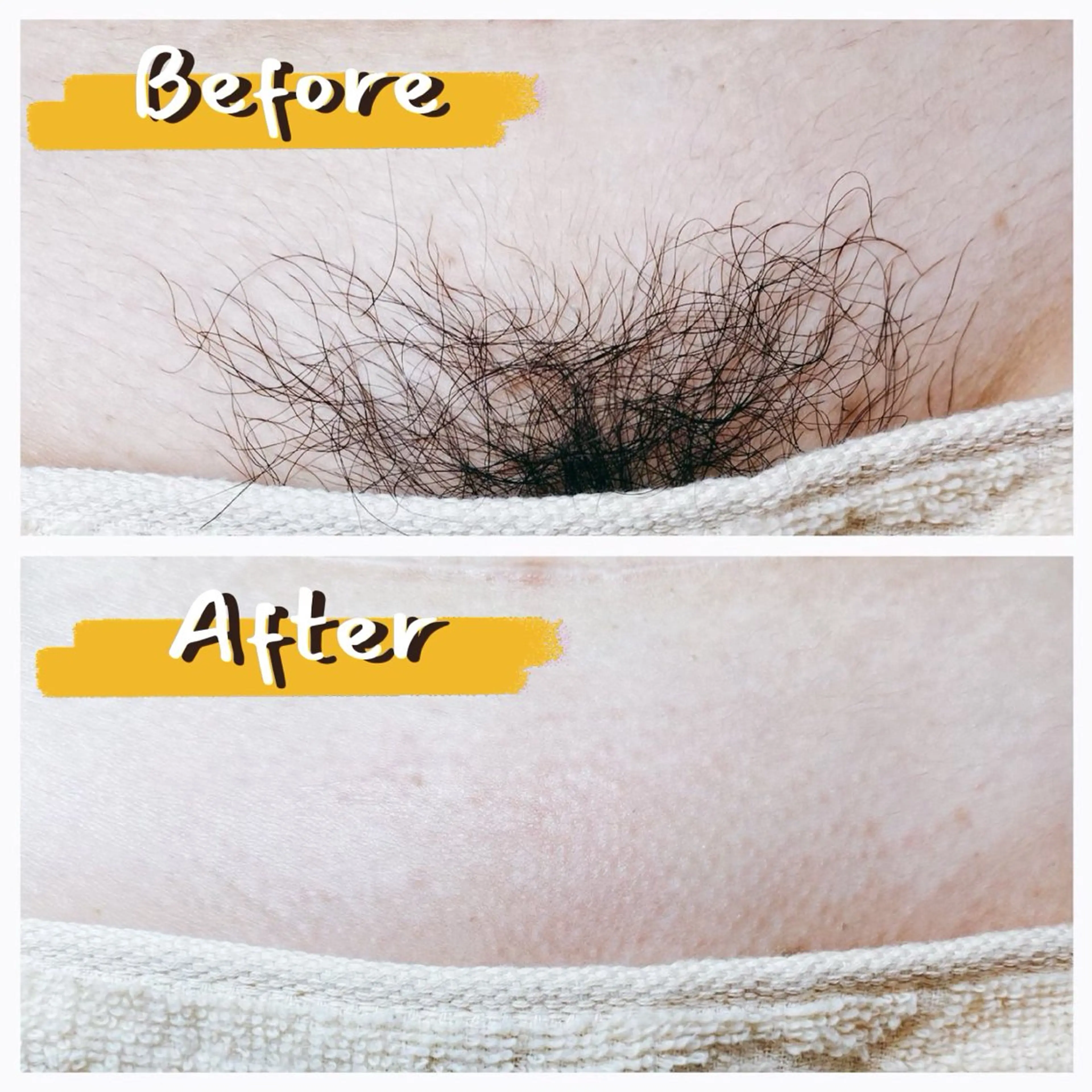 脱毛 sugaring salon Malo所属・シュガーリングサロン Maloのエステ・リラクイメージ