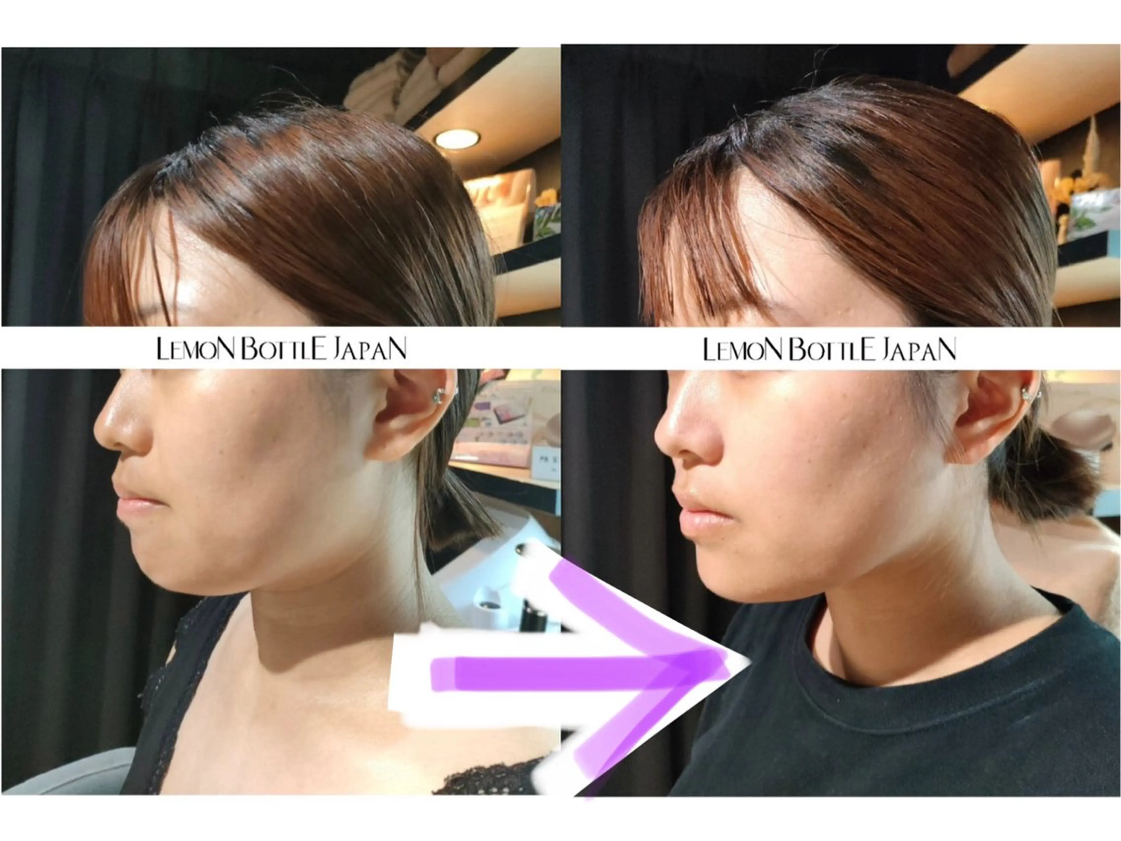 💐美肌/小顔づくり 🫧看護師🫧ASAのエステ・リラクイメージ