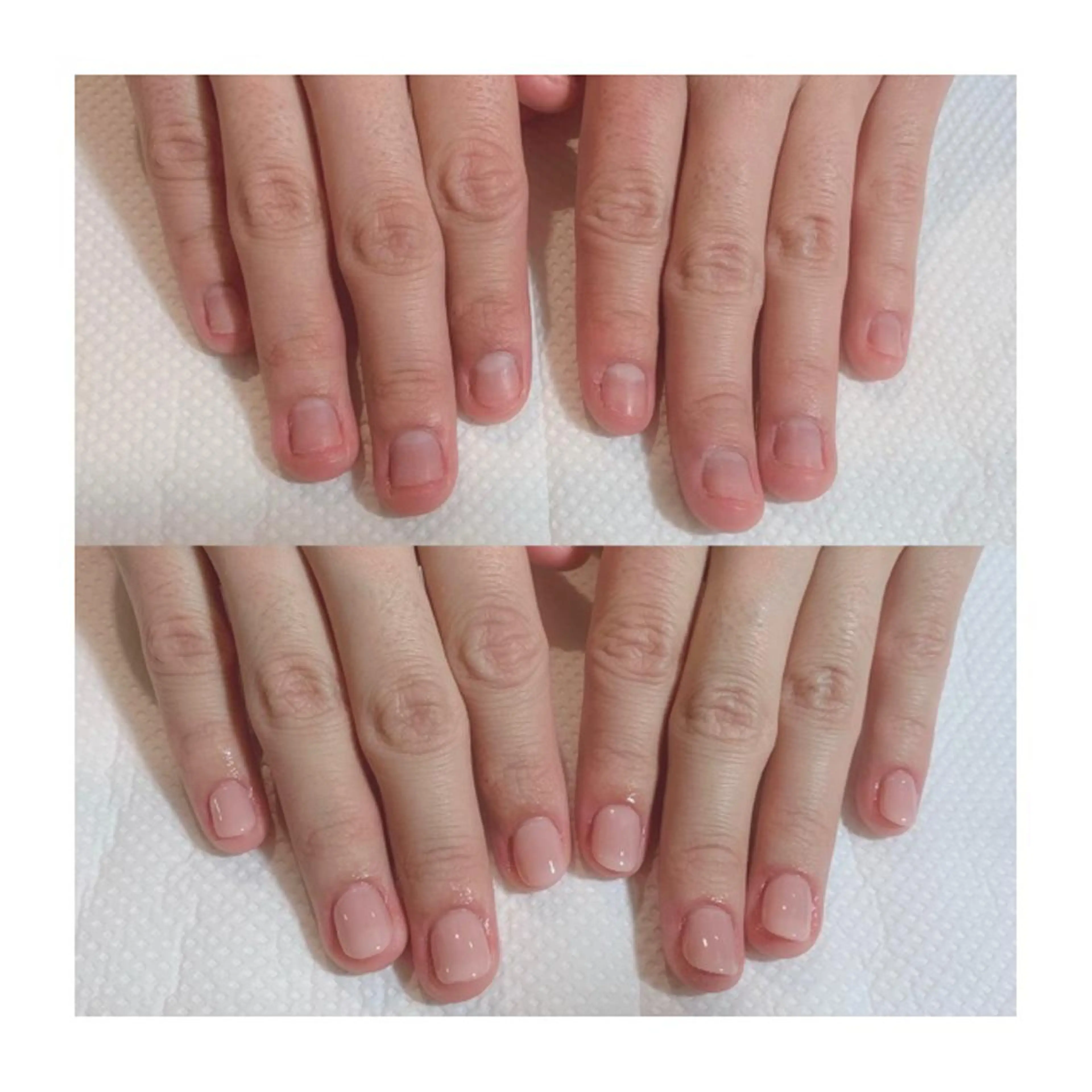 《全員》深爪ケアコース スカルプチュアで長さだし!丁寧なケア付き☆の写真