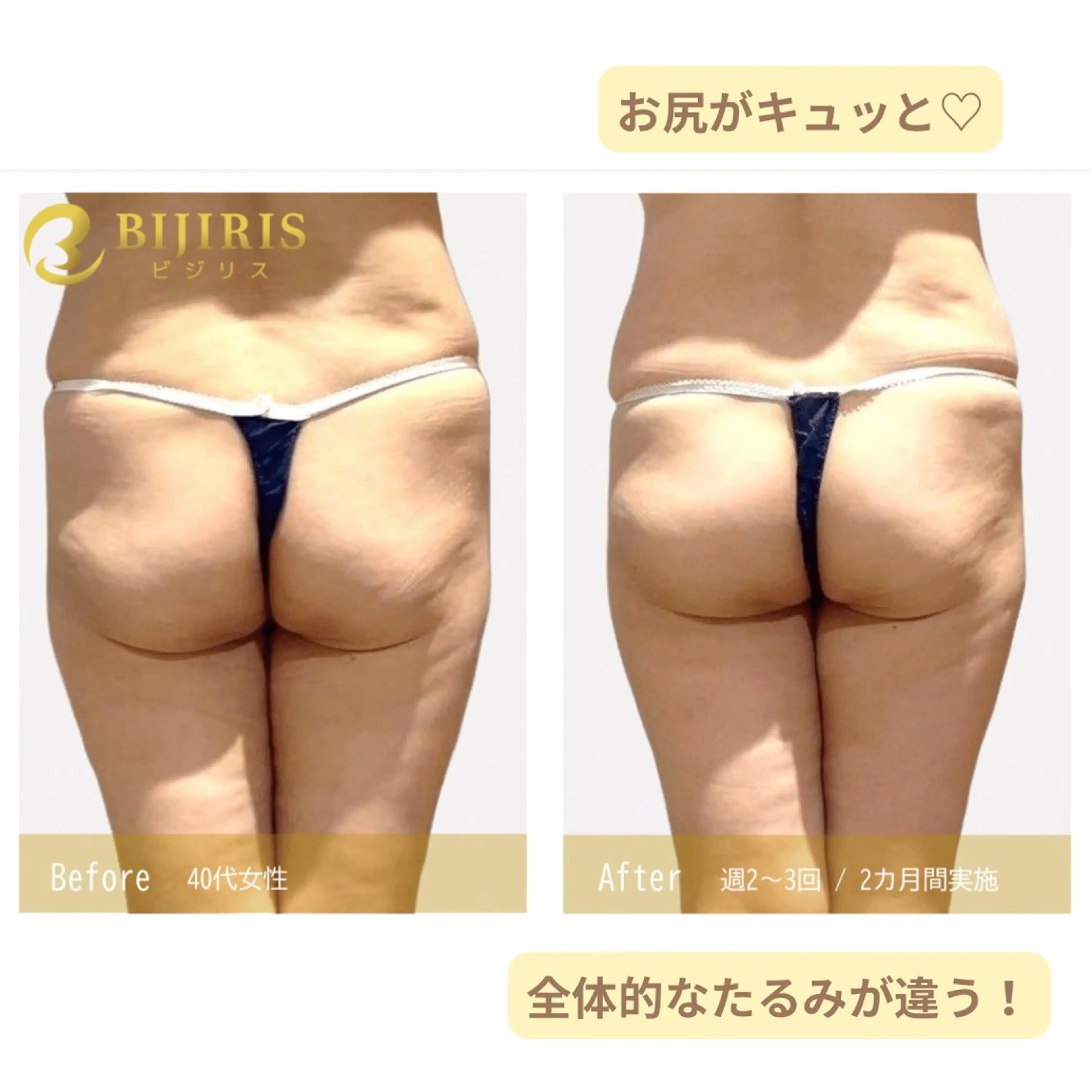 セルフ脱毛/美尻イス キングスサロン熊本のエステ・リラクイメージ