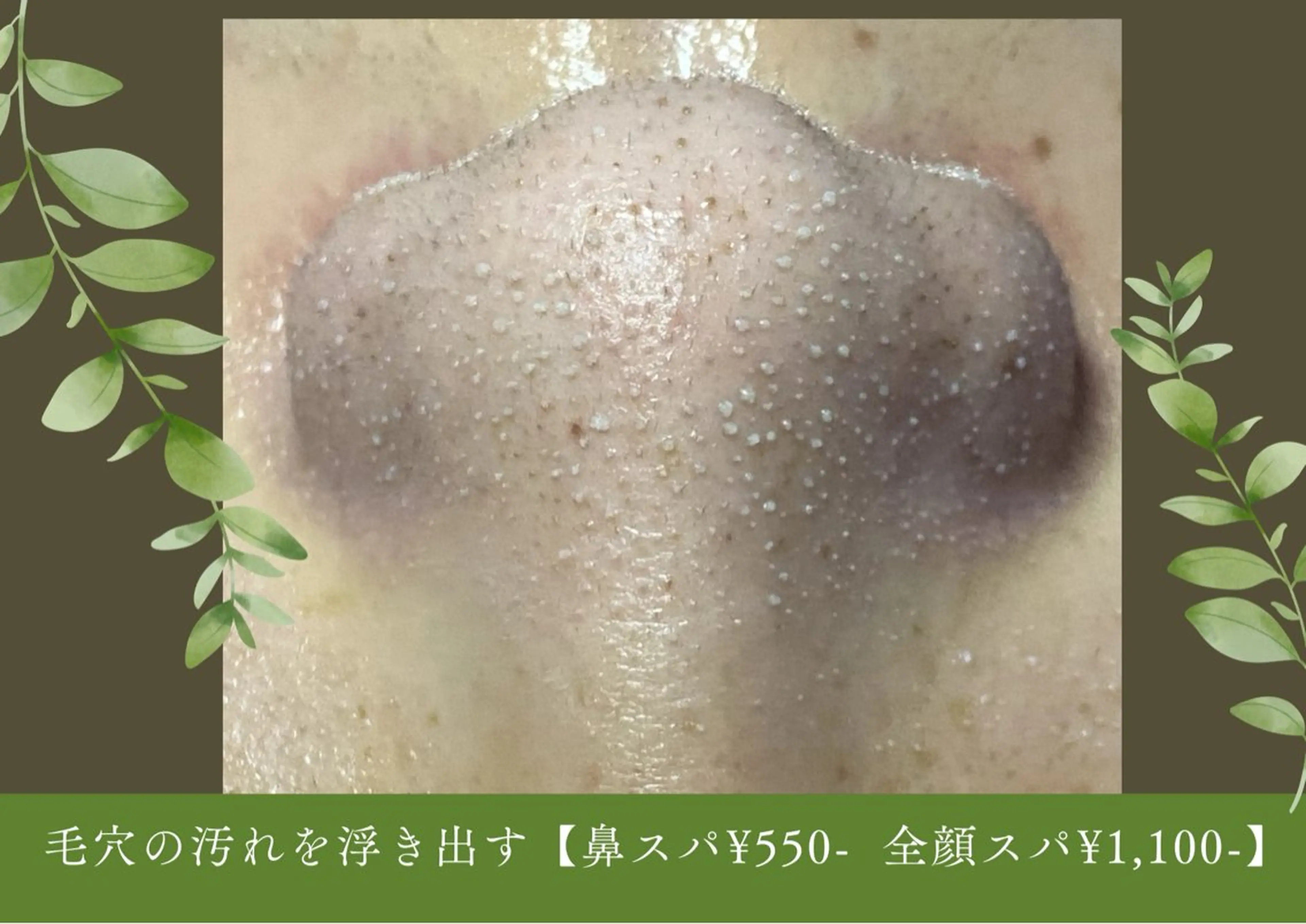 毛穴フェイシャル エステ専門店BBのエステ・リラクイメージ