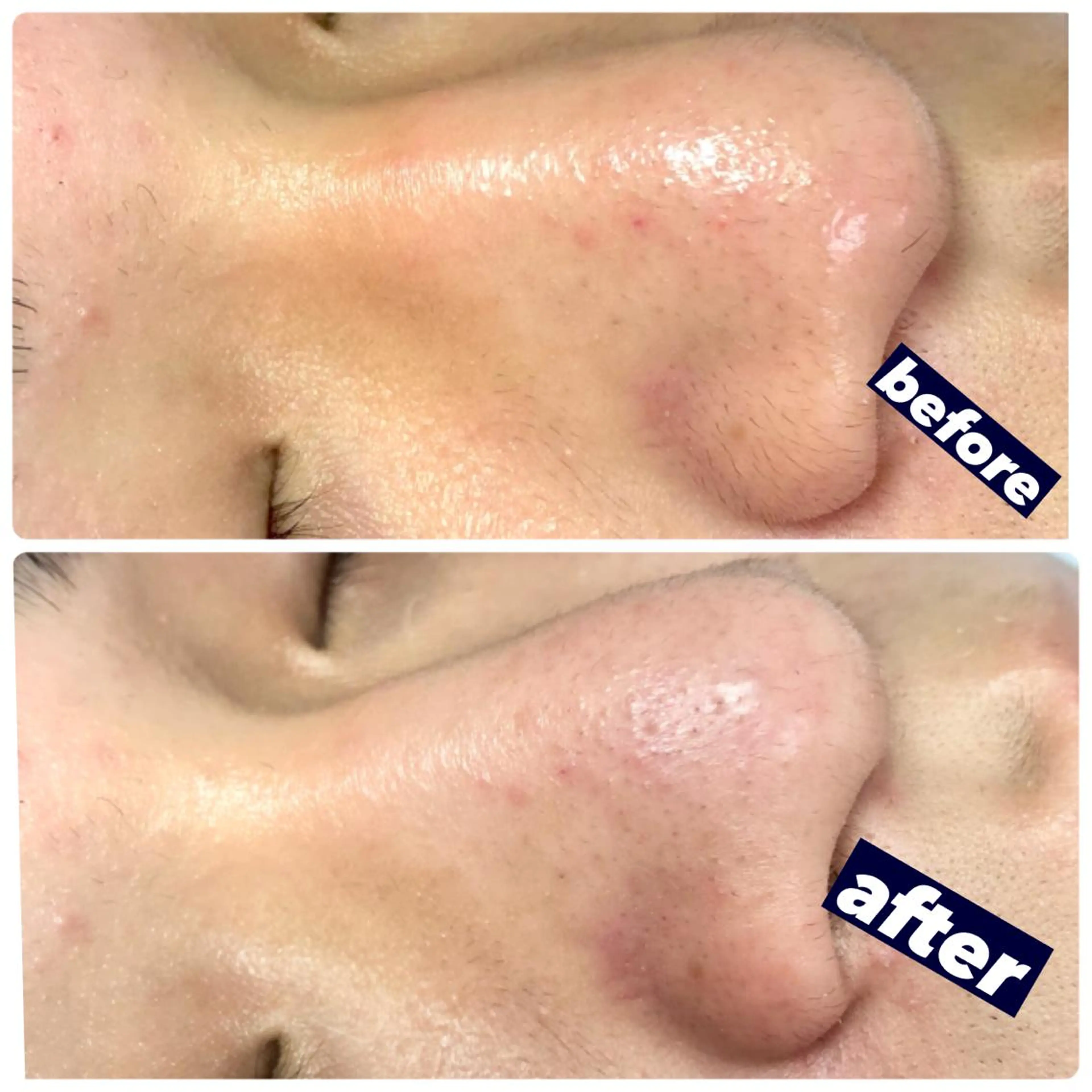 NAO 🌺のマツエク・マツパデザイン