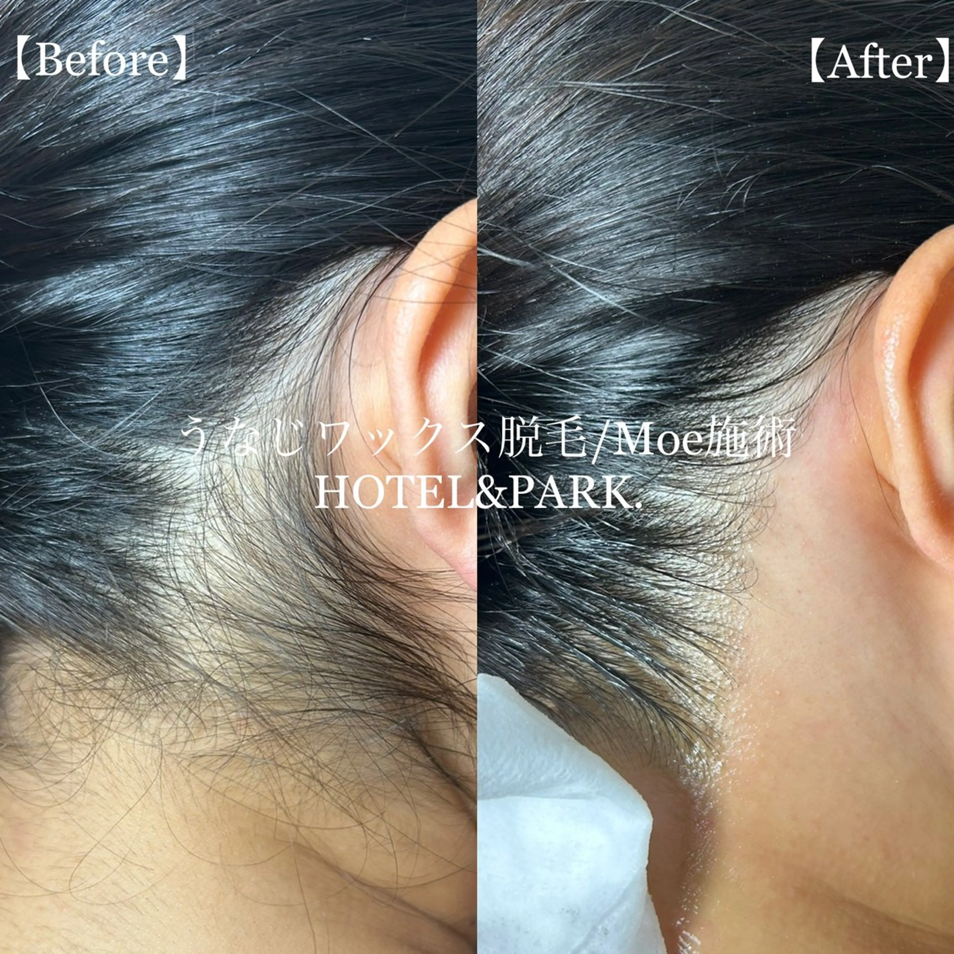 HOTEL&PARK .Moeワックス脱毛のエステ・リラクイメージ