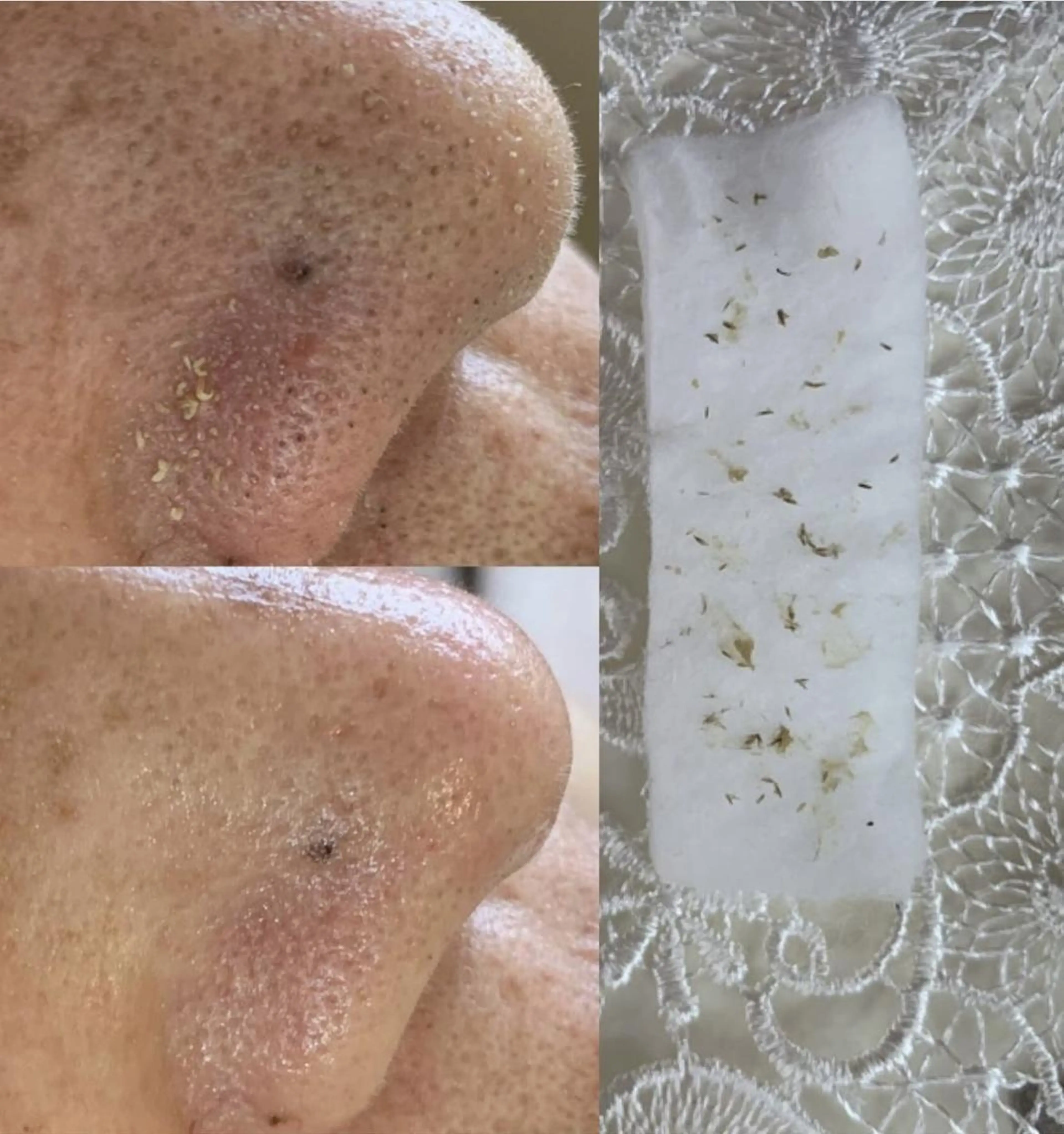 エステ 毛穴黒ずみ改善🥇 ✨シフォン豊田✨のエステ・リラクイメージ