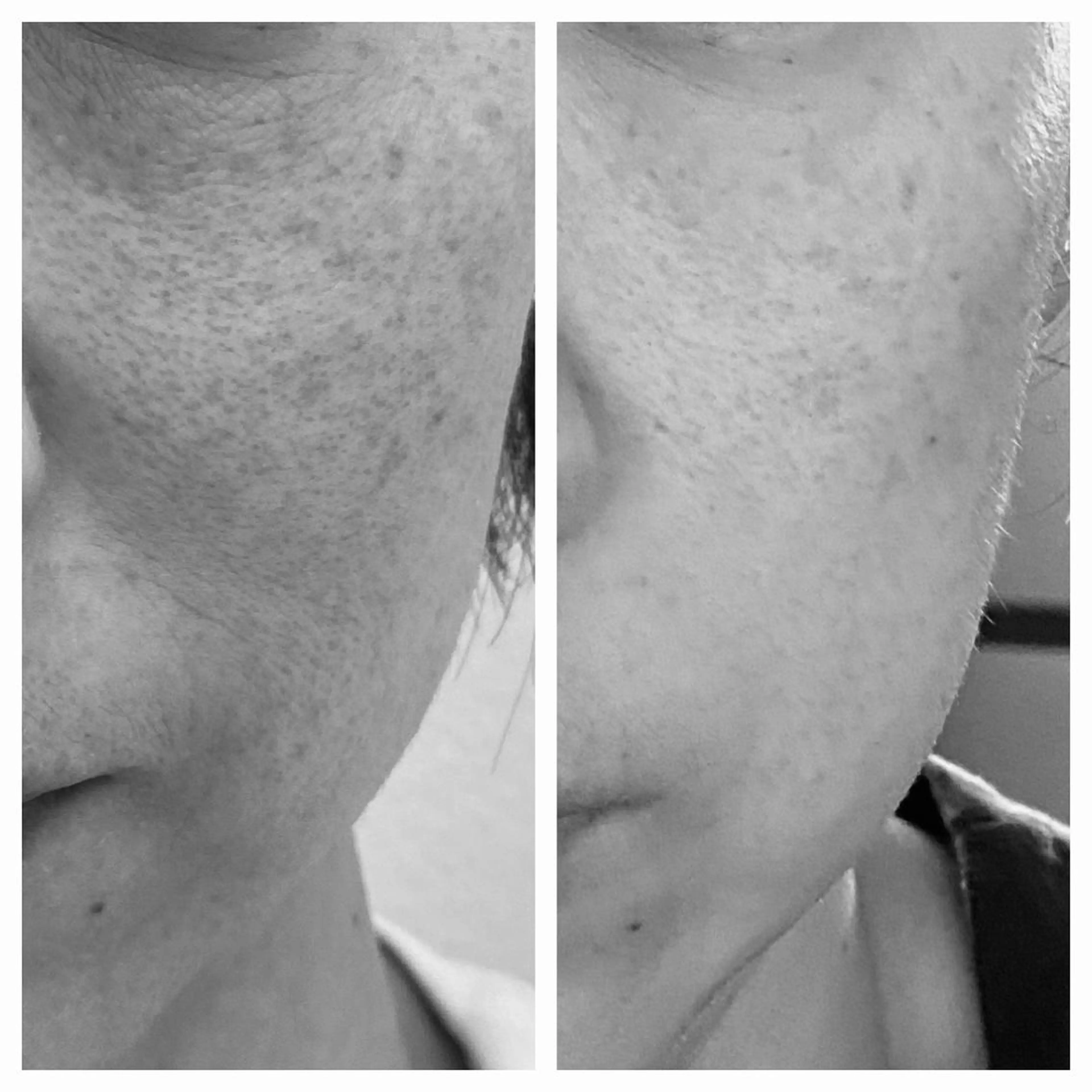 salon.plaisir（プレズィール）所属・酒井 瑠未のエステ・リラクイメージ