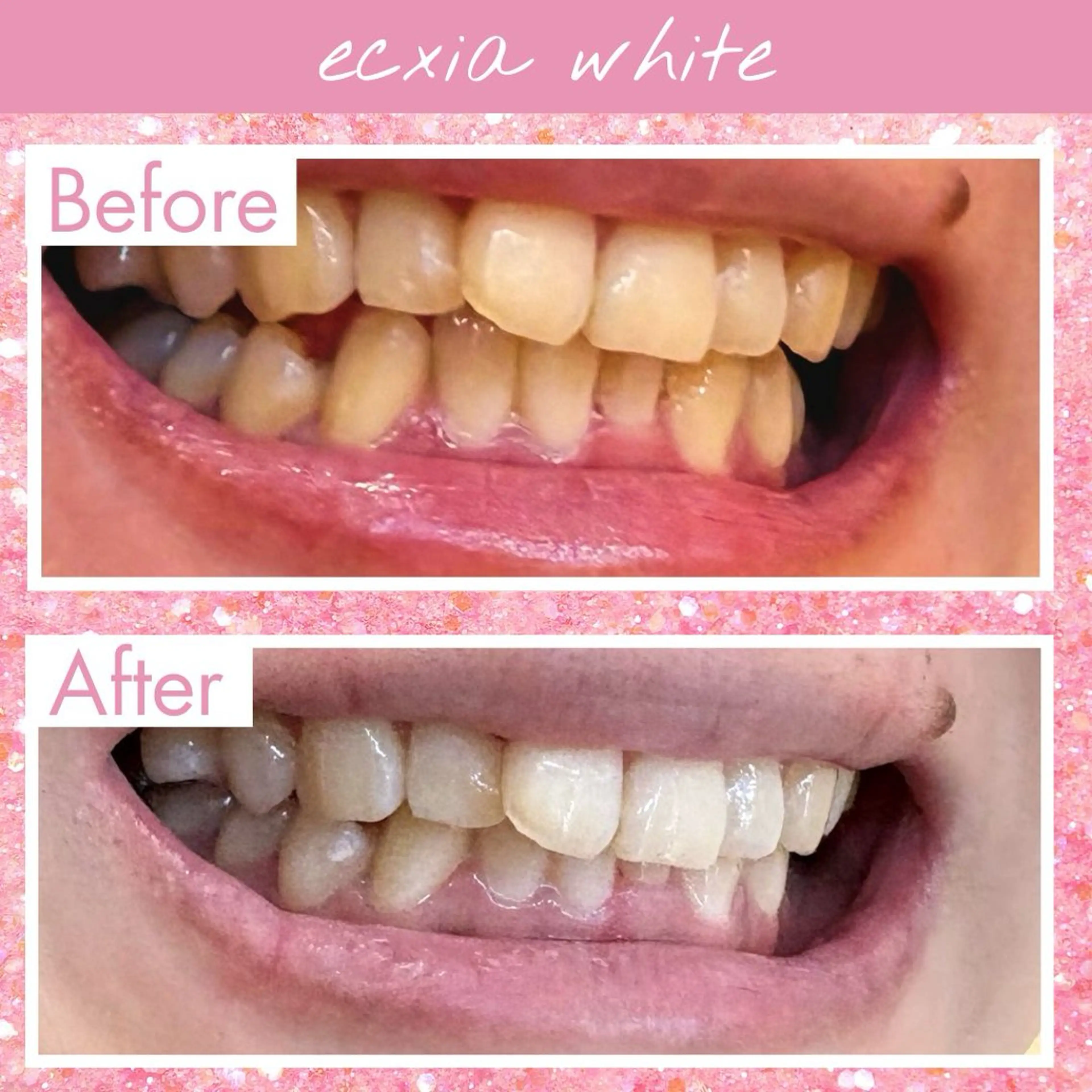 セルフホワイトニング エクシア宮崎花ヶ島店のその他イメージ