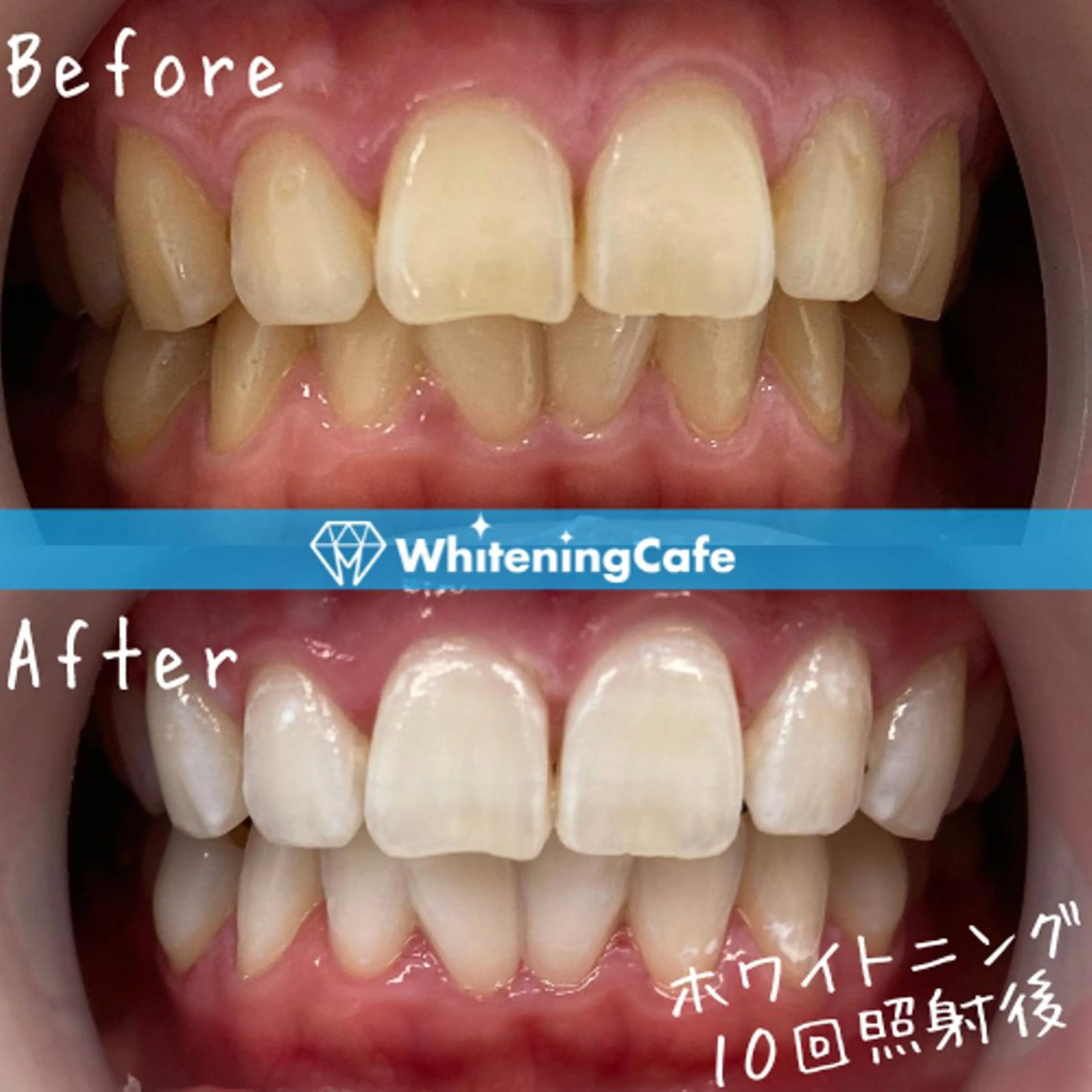 メンズ エステ リラク ホワイトニング カフェ川越店のエステ・リラクイメージ