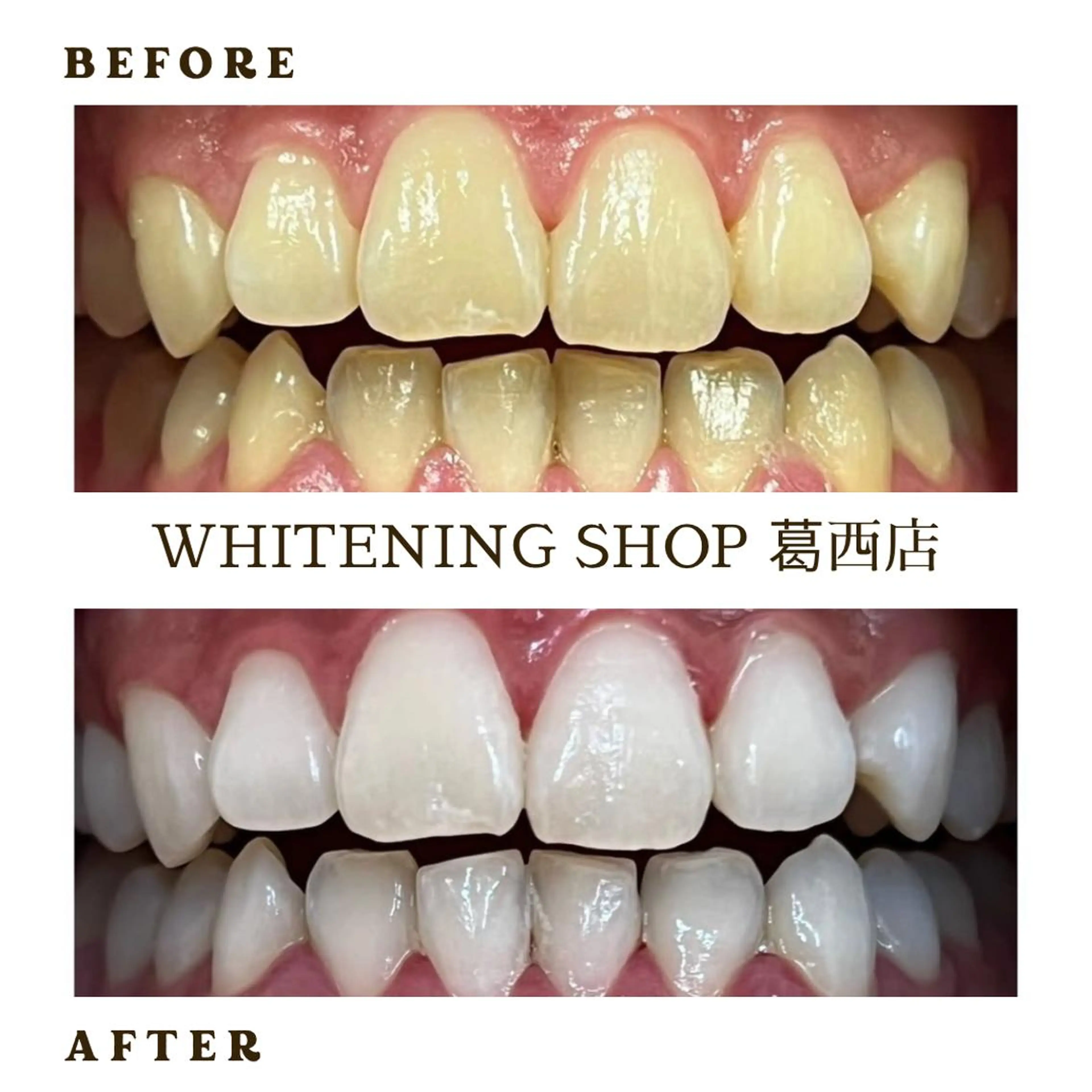 メンズ その他 ホワイトニング ショップ葛西店のその他イメージ