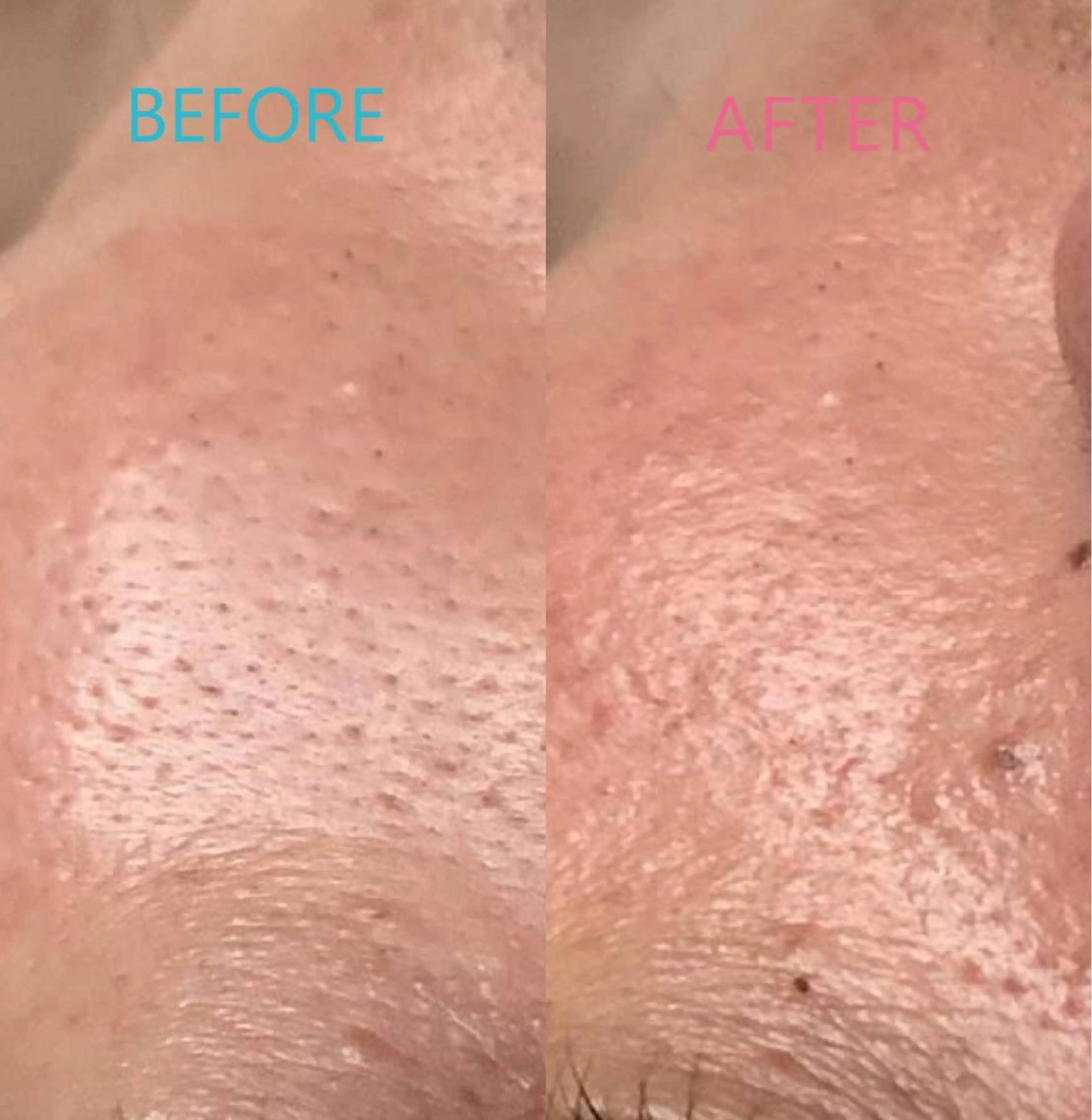 ハウオリベリー所属・うえば すみかのエステ・リラクイメージ