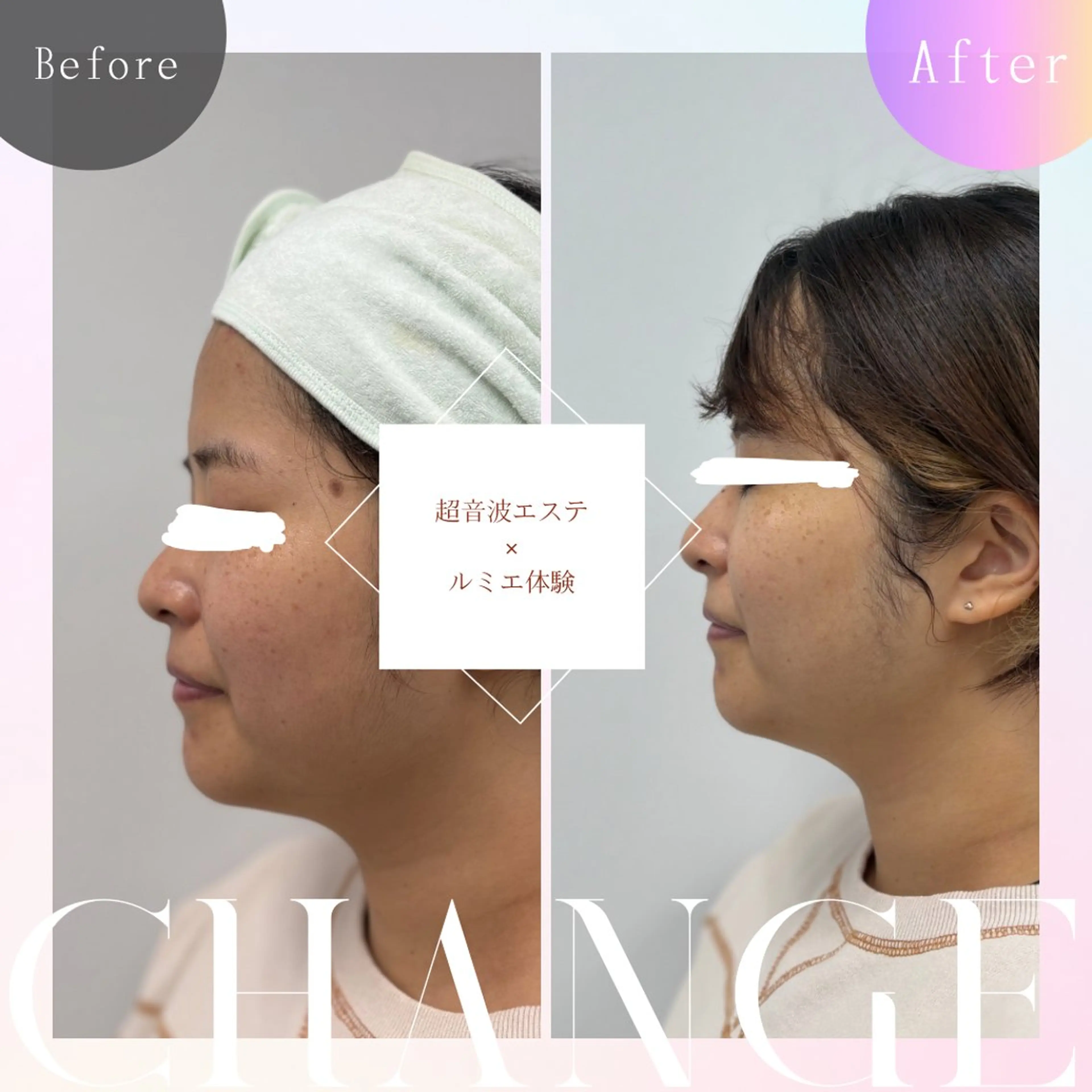 エステ skinLabo所属・saya Mのエステ・リラクイメージ