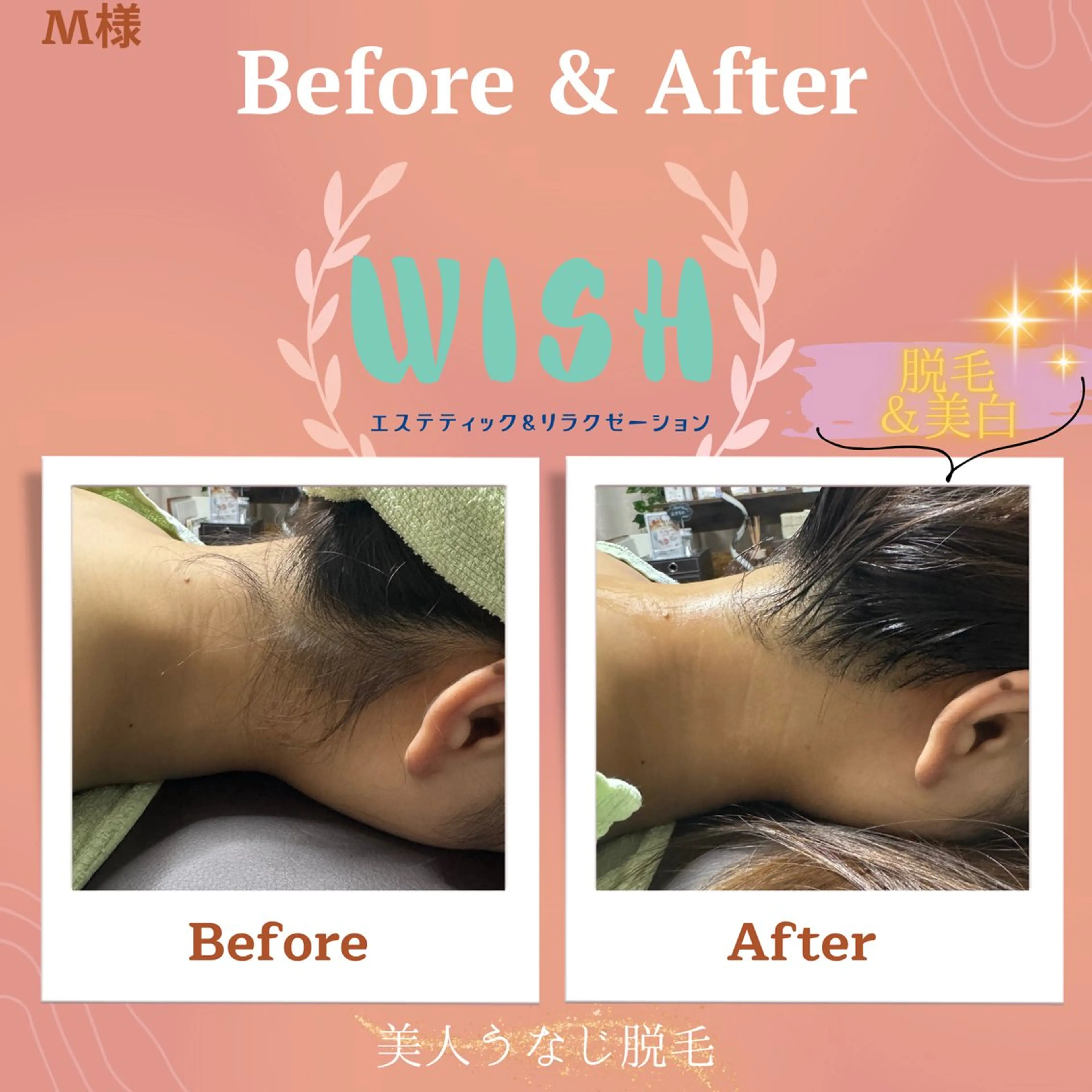 WISH 美肌脱毛のプロ！須藤のエステ・リラクイメージ