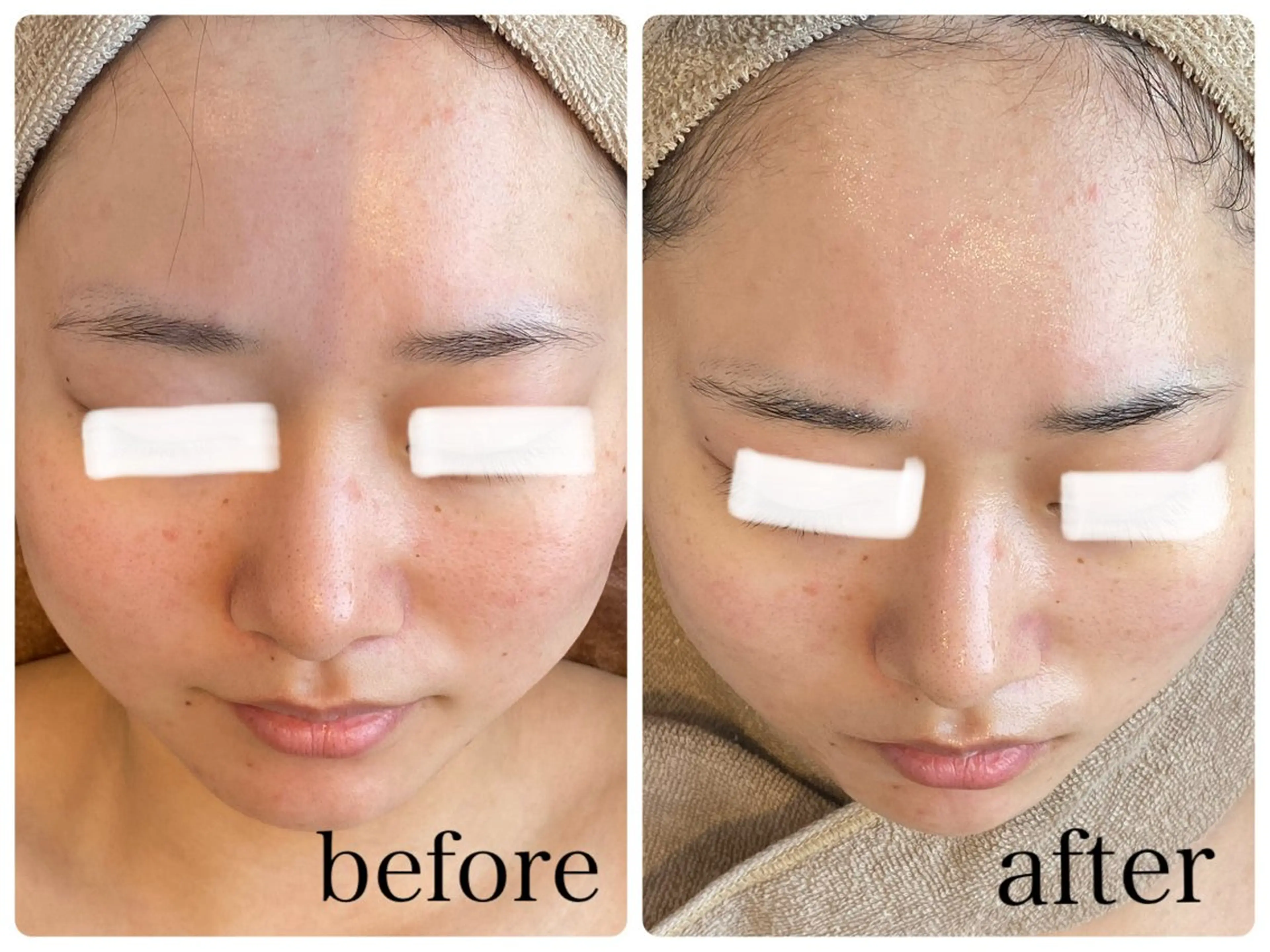 MISEL  2nd所属・主島 葉月のエステ・リラクイメージ