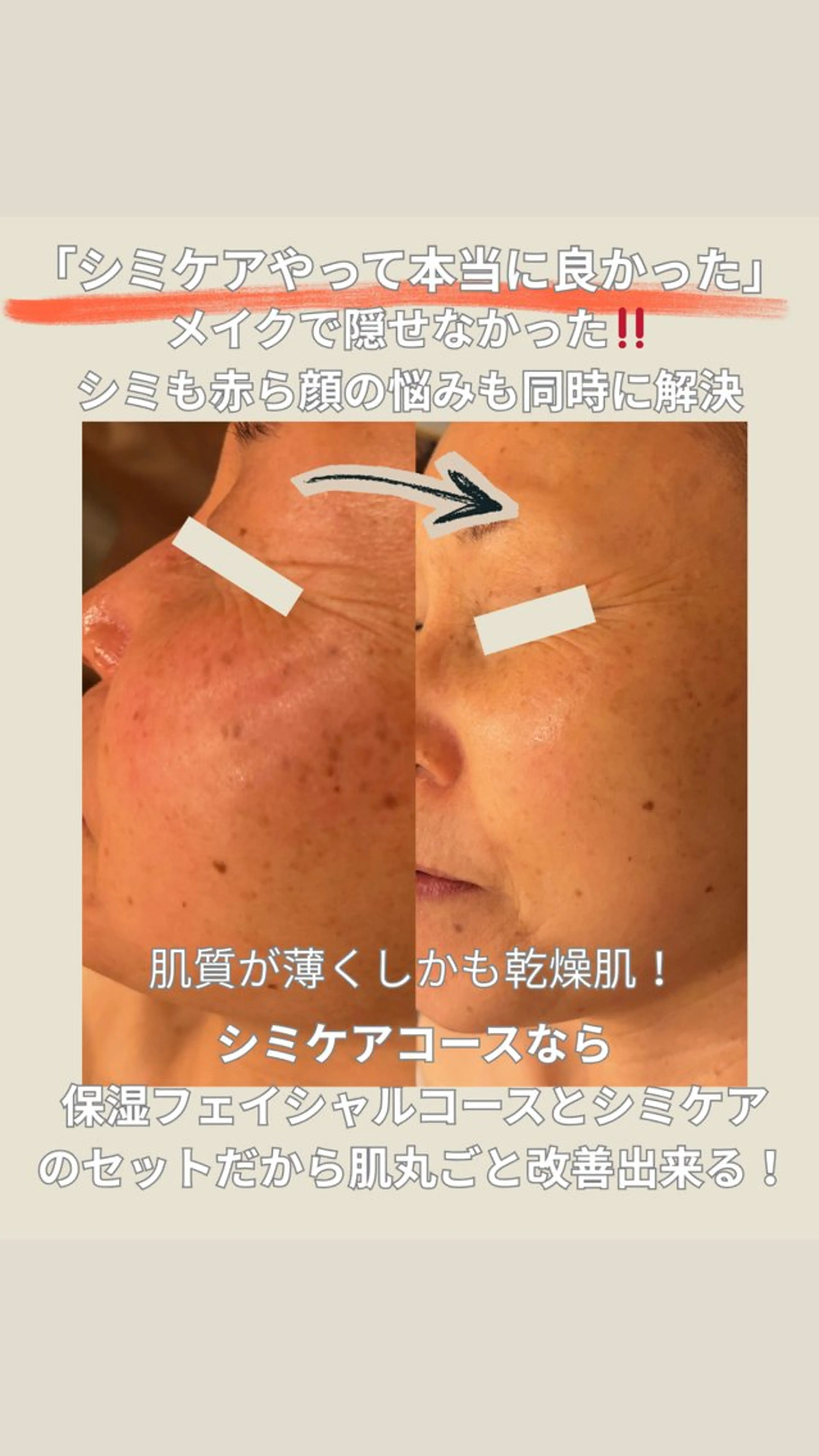 エステ エステサロン グラマラスのエステ・リラクイメージ