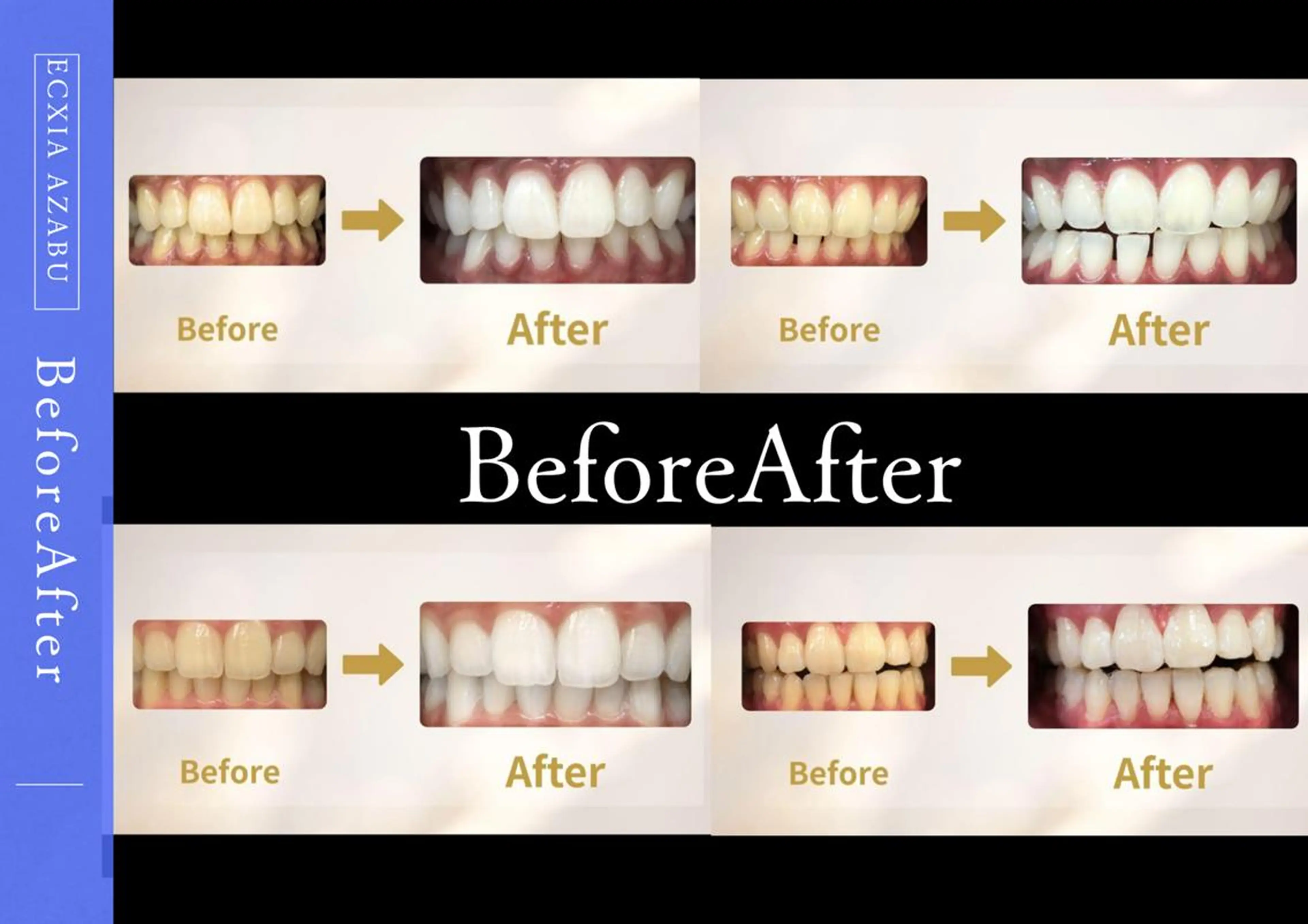 【minimo 限定】　9分2回施術で美白効果◎　ポリリン酸配合の写真