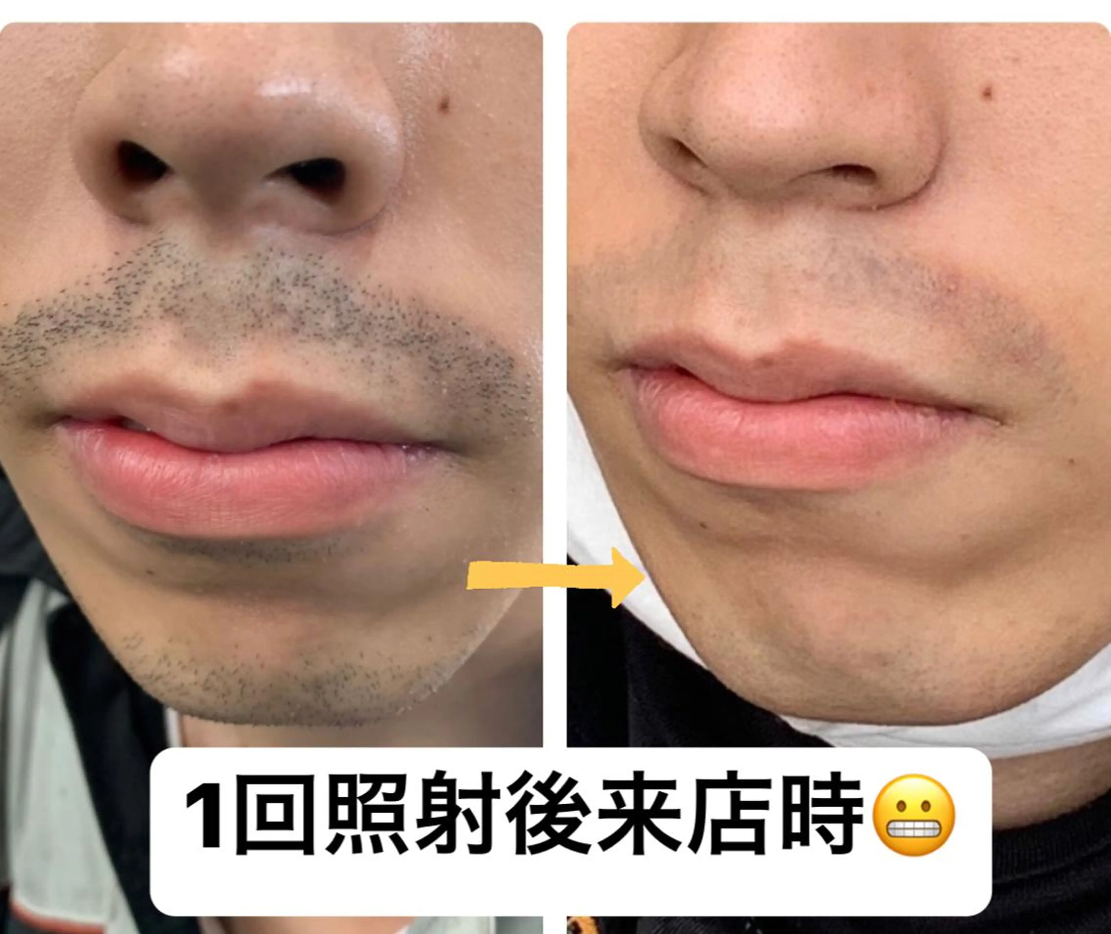 脱毛 メンズ脱毛サロン Le falcoのエステ・リラクイメージ