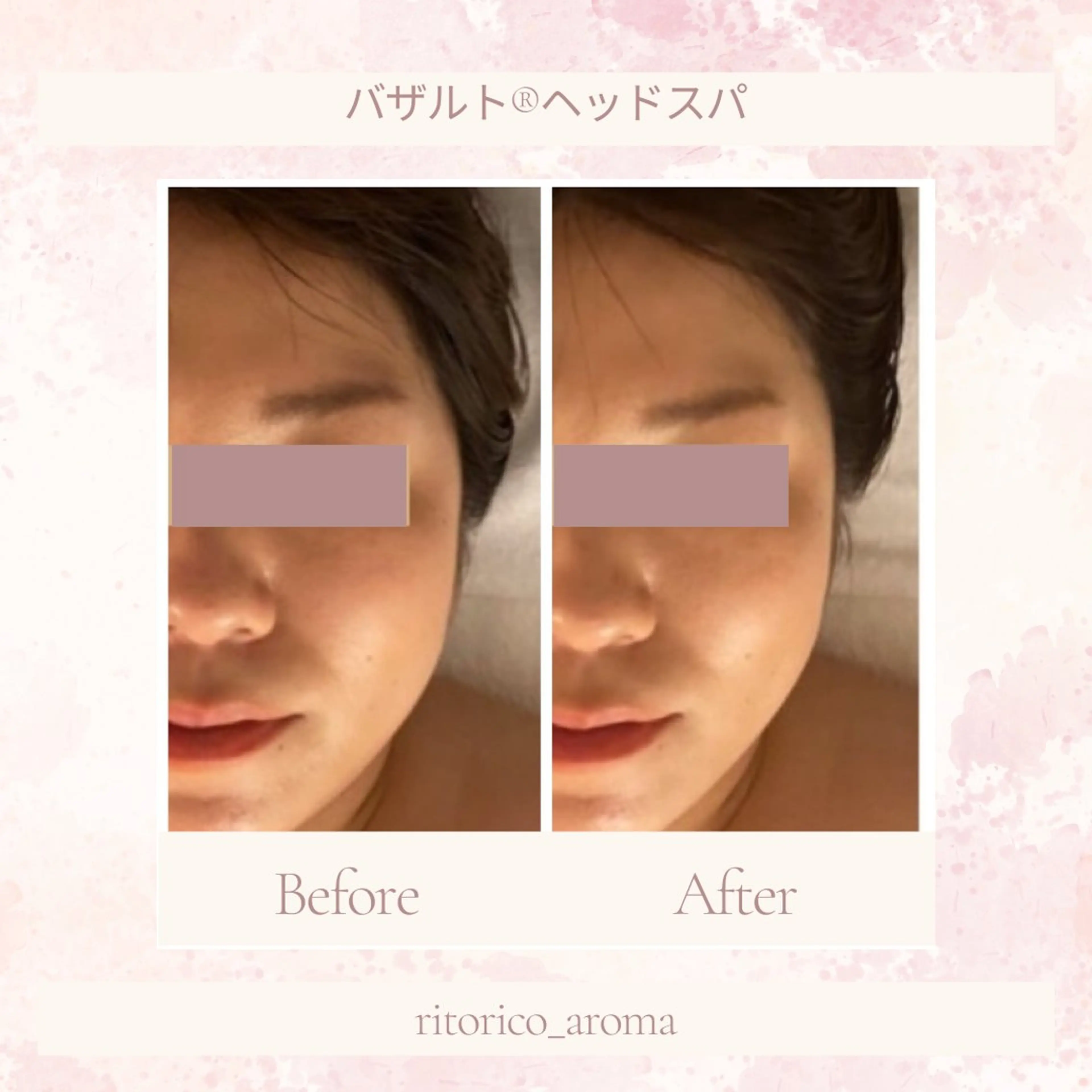 《新感覚ヘッドスパ》睡眠・眼精疲労に／デコルテ＋足浴＆保湿マッサージ付 70分 ¥5500の写真