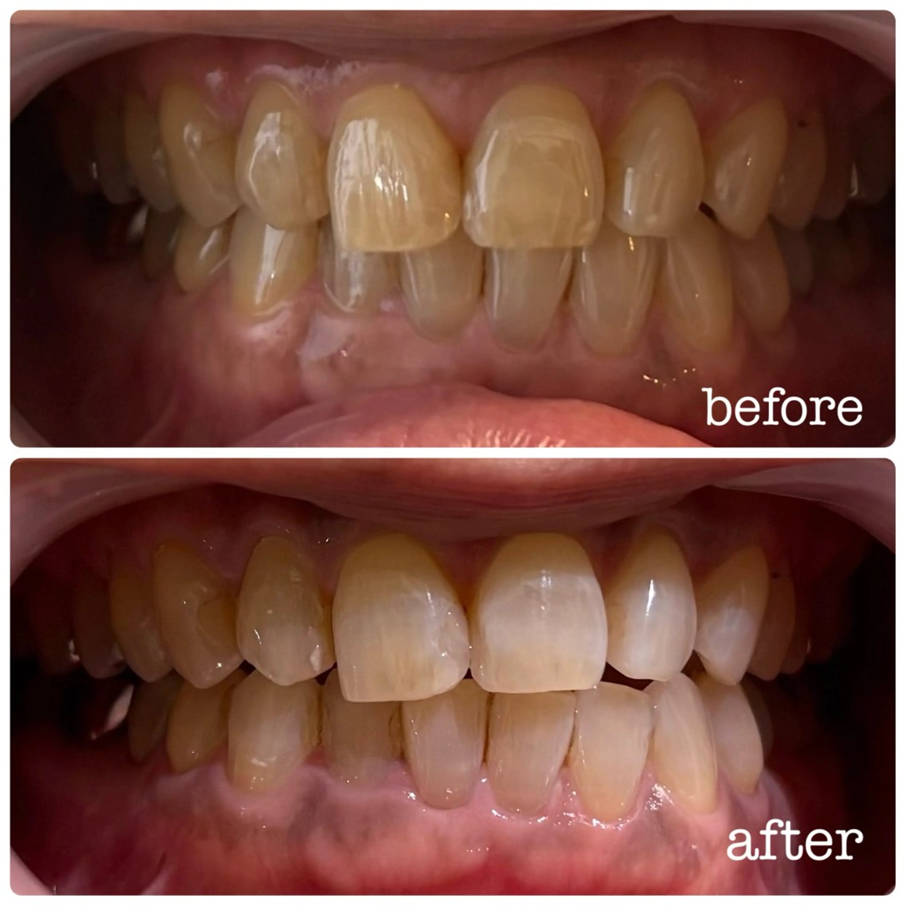 その他 DH. MISATOの眉毛・アイブロウイメージ