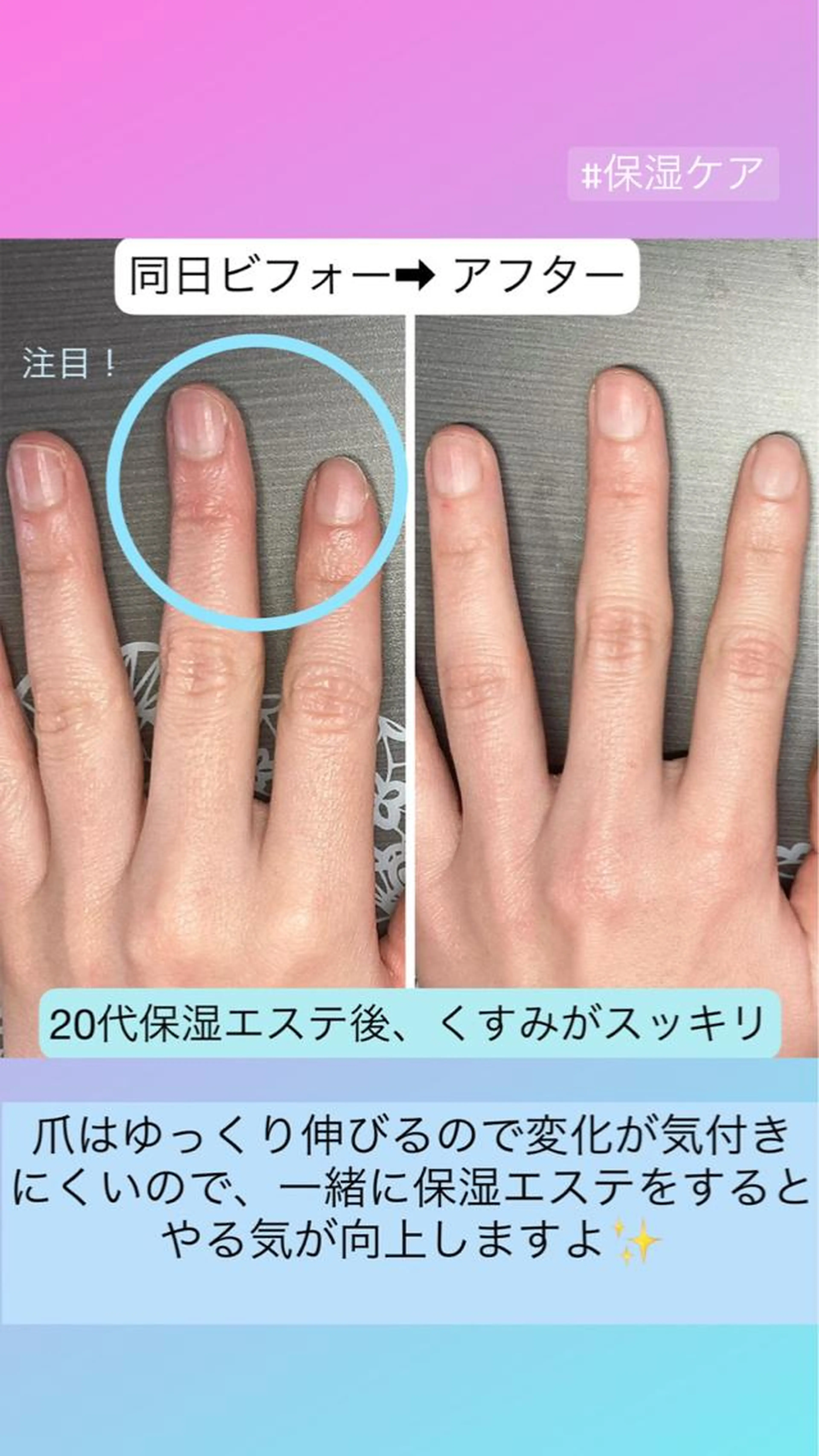 自爪育成ネイルケア➕鹿茸ホットパック(初回相談料込み)ほんのり温かい！手のシワ、ハリ，潤いに⭕️メンズもOK！の写真