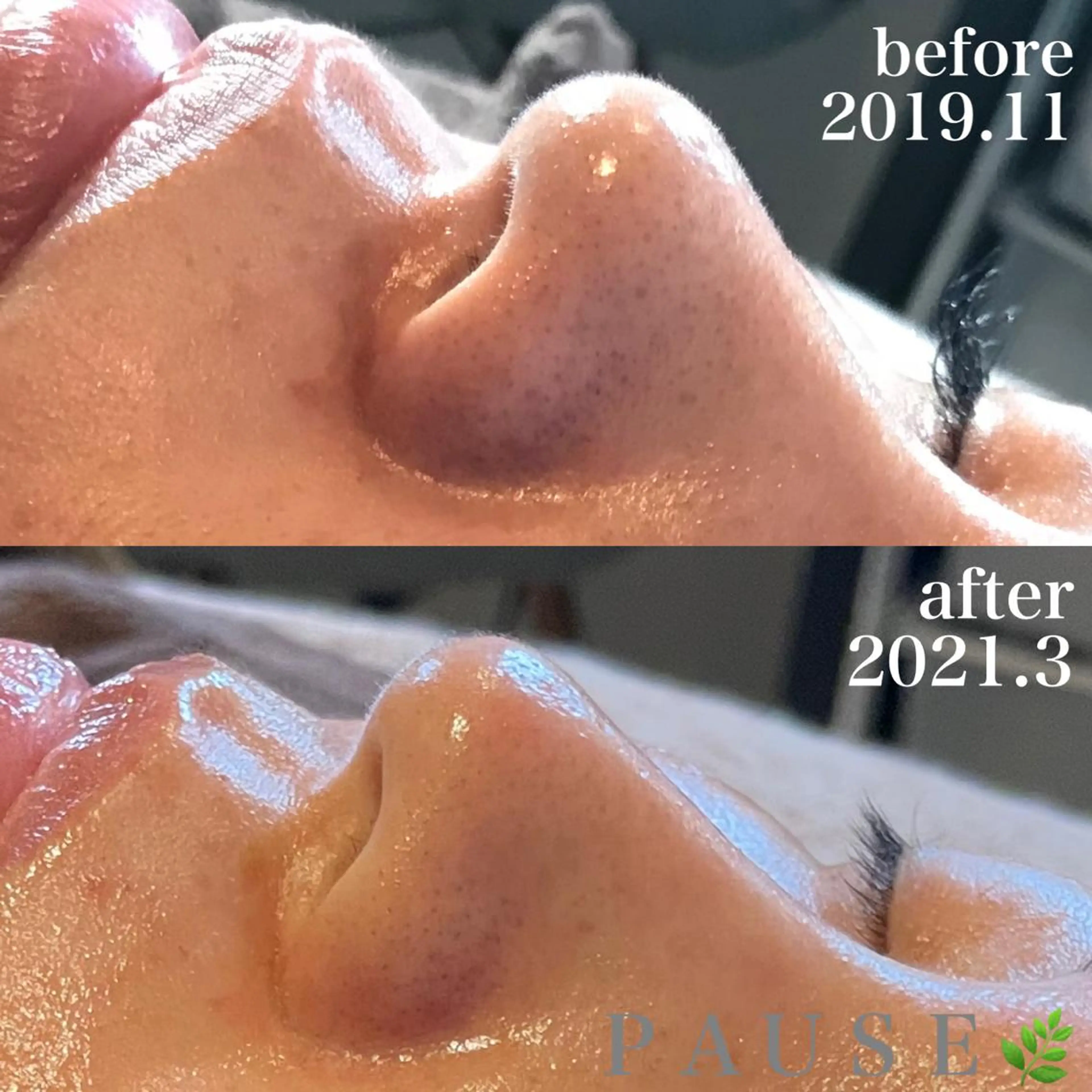 エステ 浜野 恵美のエステ・リラクイメージ