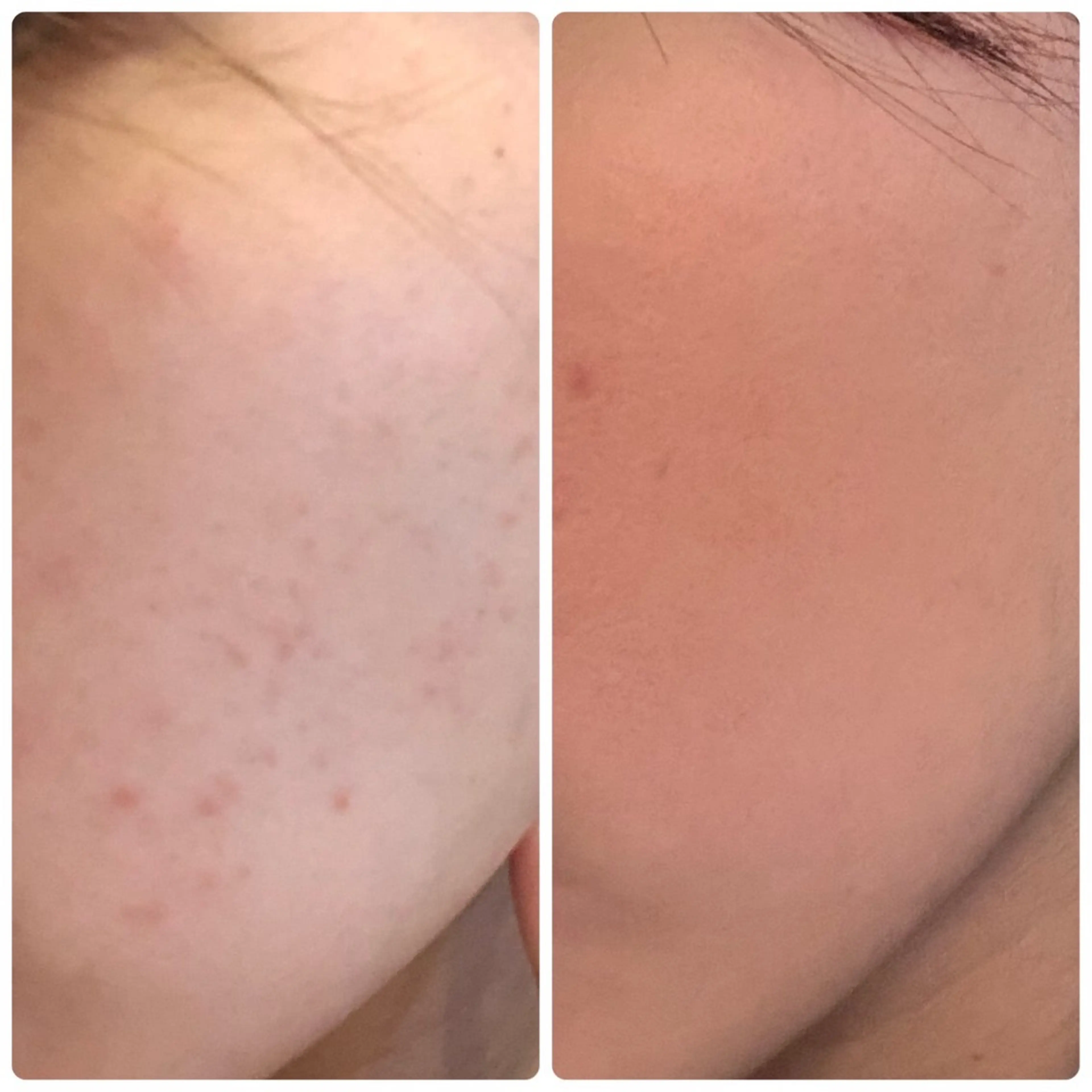 エステ 自由が丘📍 Belrougeのエステ・リラクイメージ