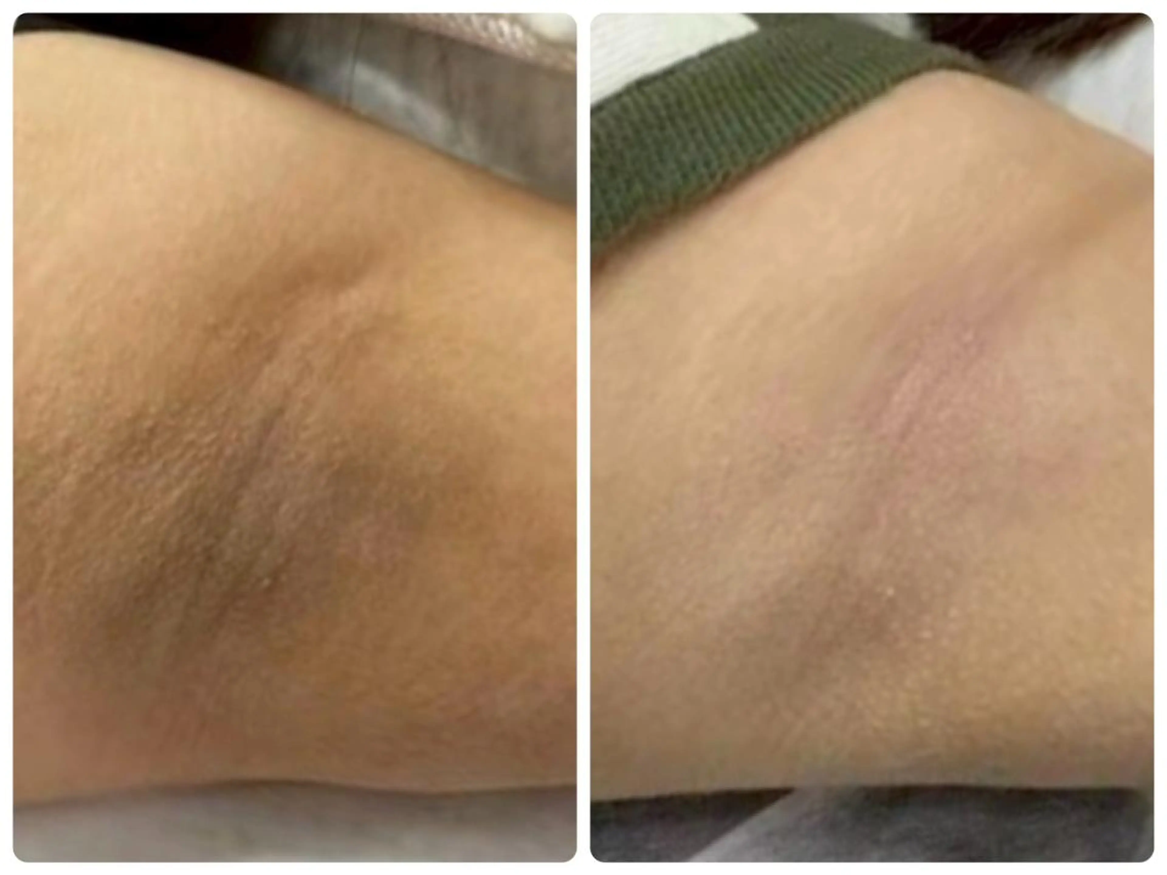 エステ 脱毛×肌管理サロン ルネルのエステ・リラクイメージ