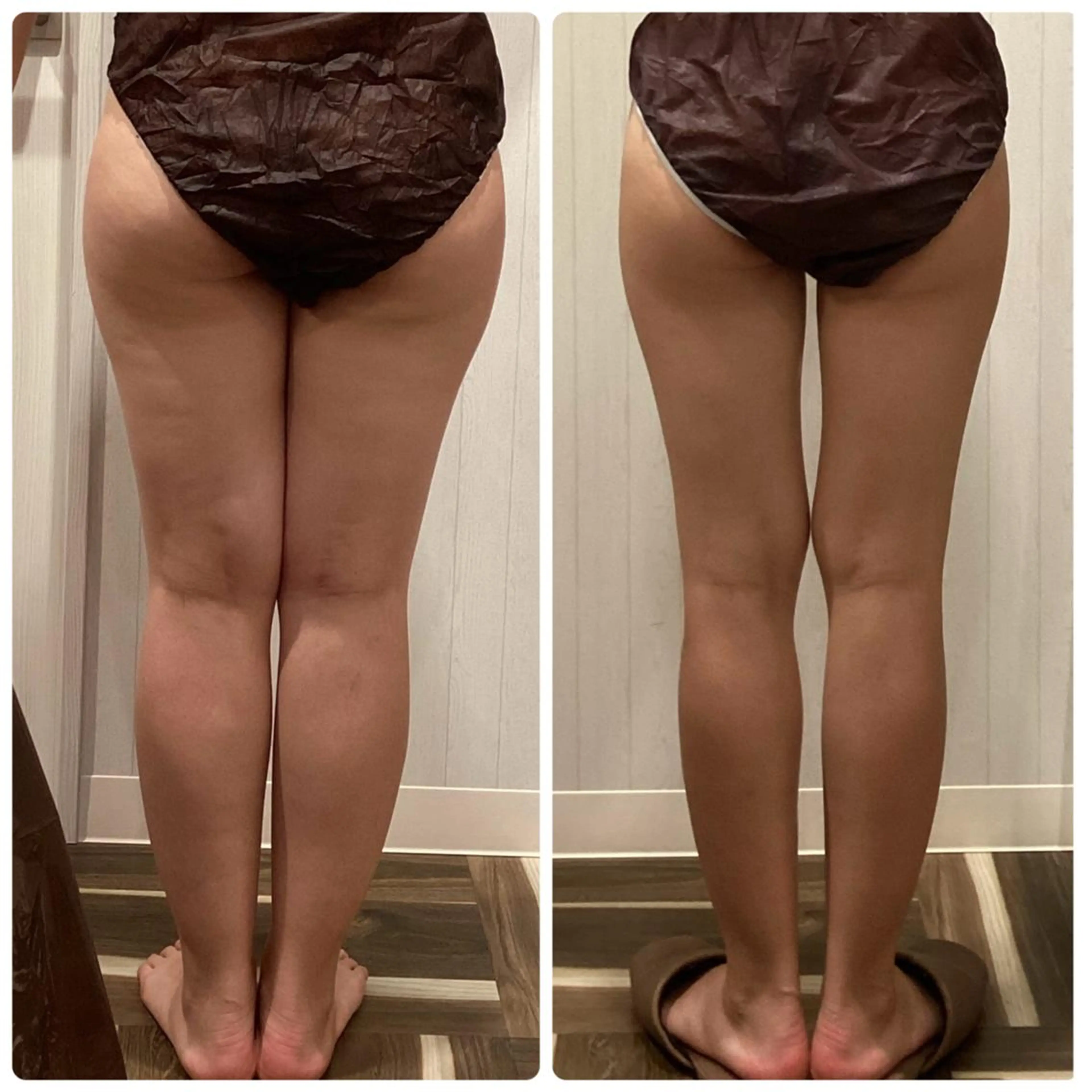 エステ 痩身脱毛専門店 Partirのエステ・リラクイメージ