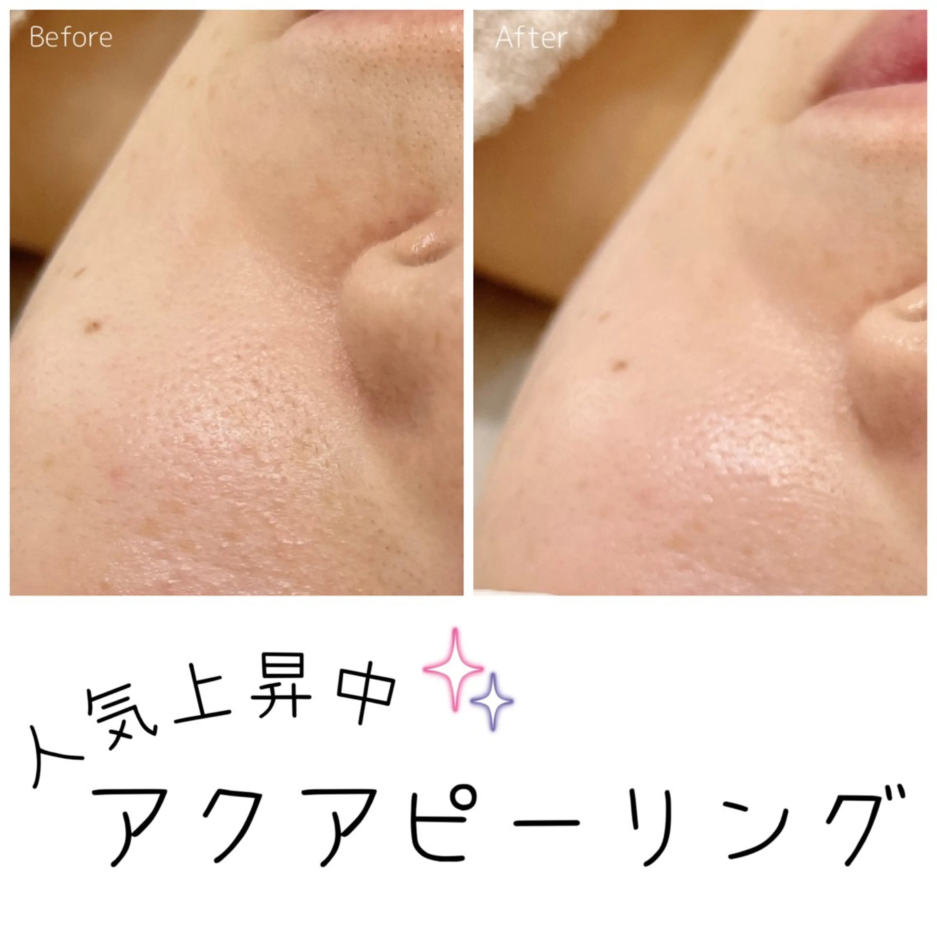 エステ 髪/まつげ/眉/毛穴 ハーブ/他/AIKOのその他イメージ