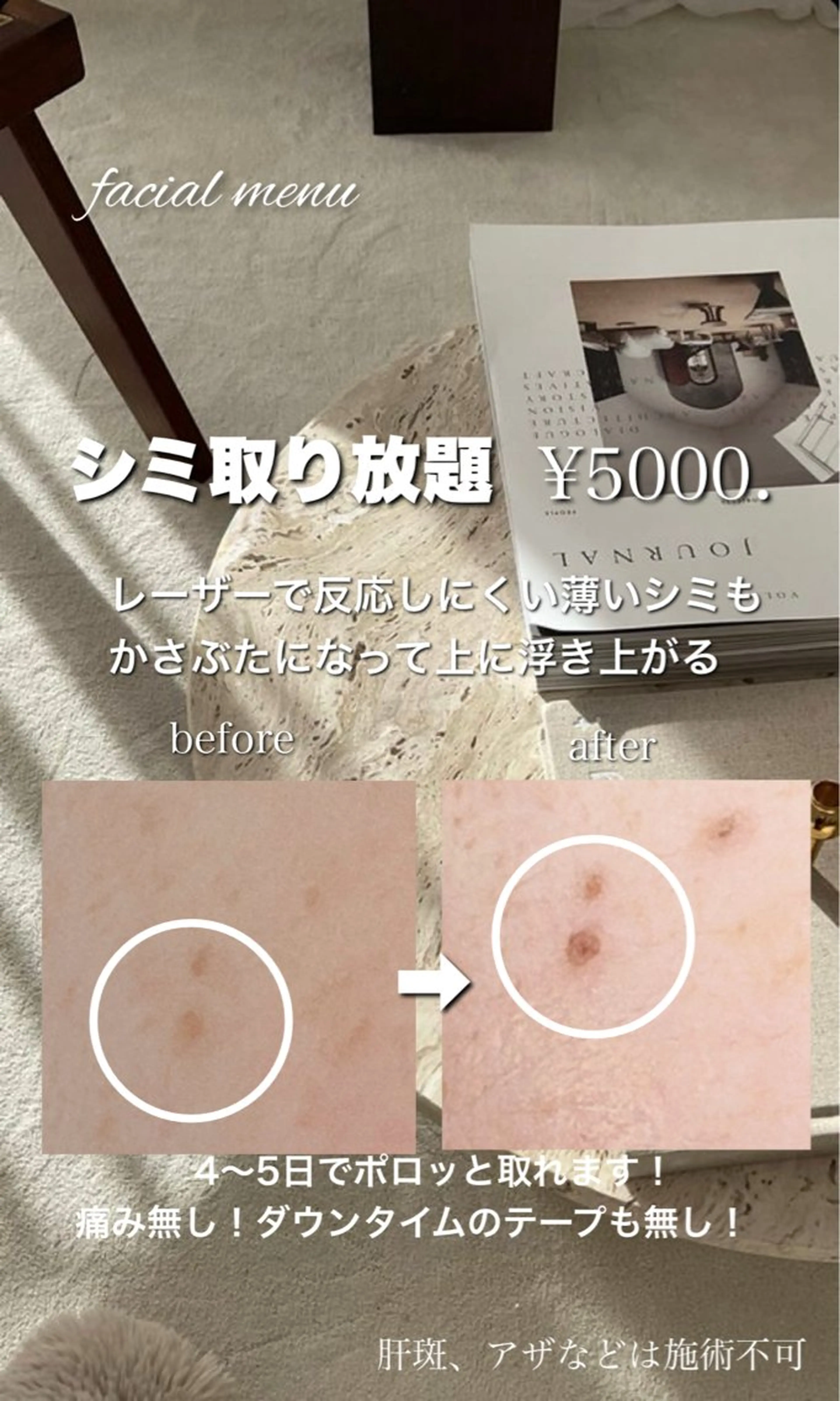 M. lisyelのエステ・リラクイメージ