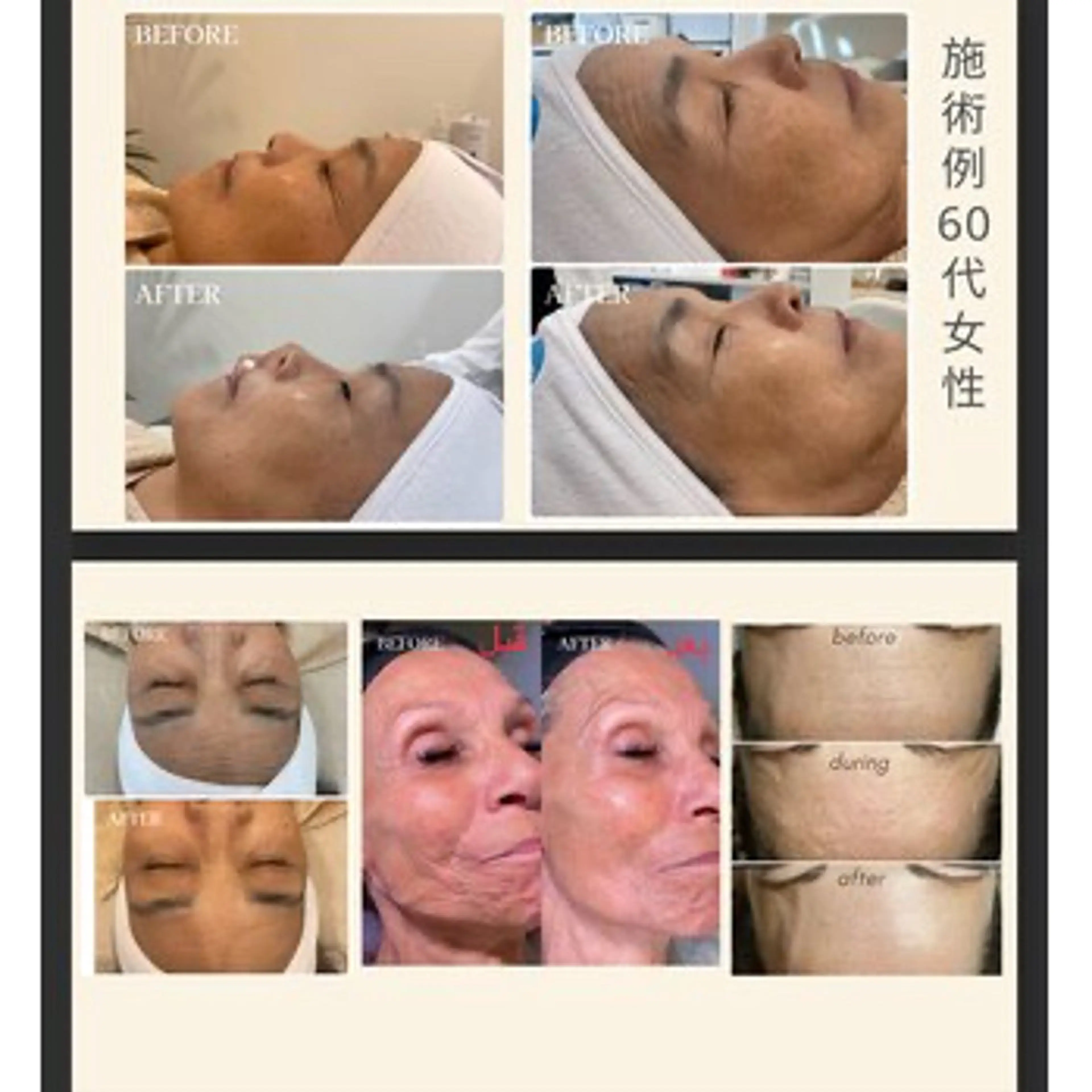 エステ 艶肌ワックス ALLY.のエステ・リラクイメージ