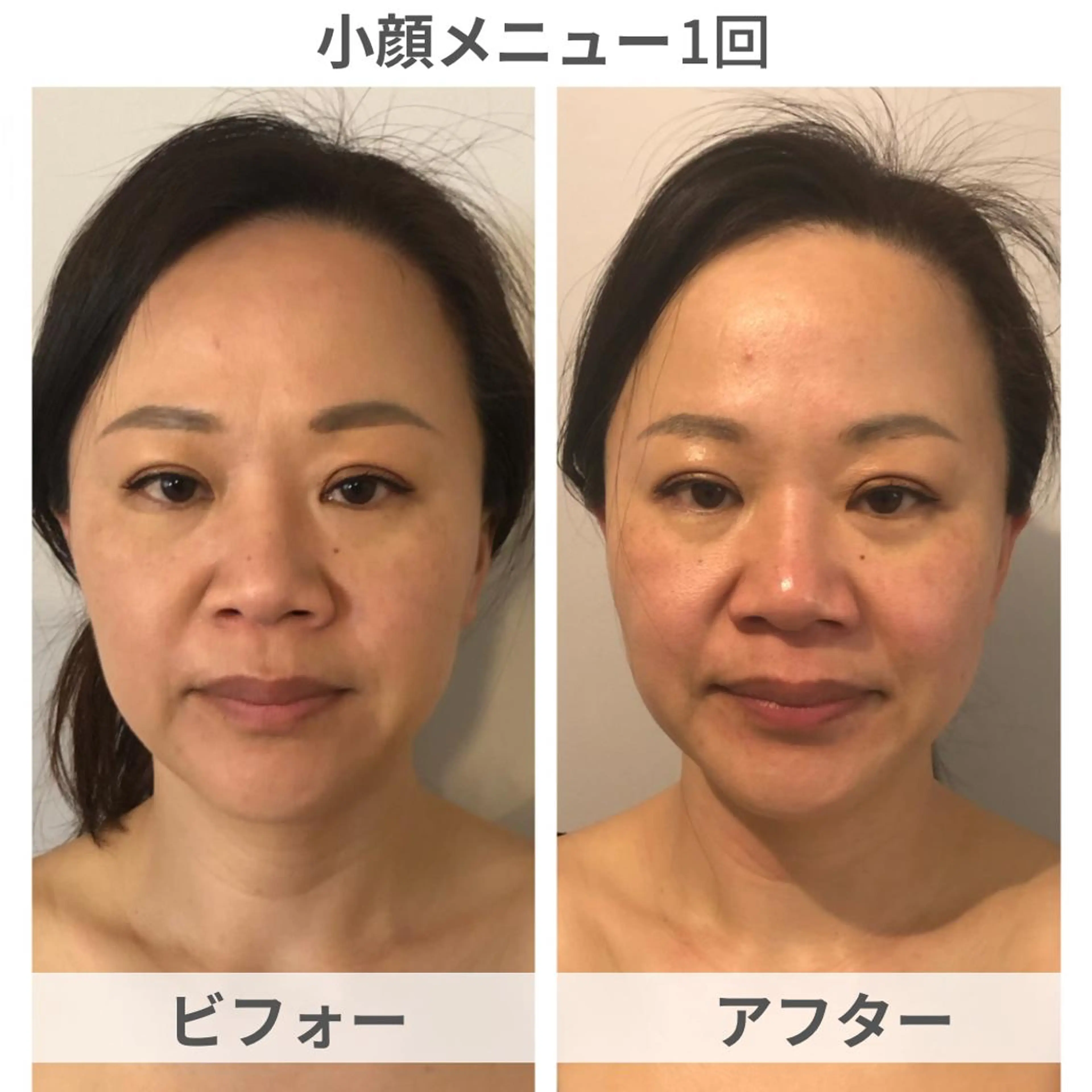 小顔・痩身専門店 Sunao所属・小顔.足痩せ整体 痩身天六Sunaoのその他イメージ