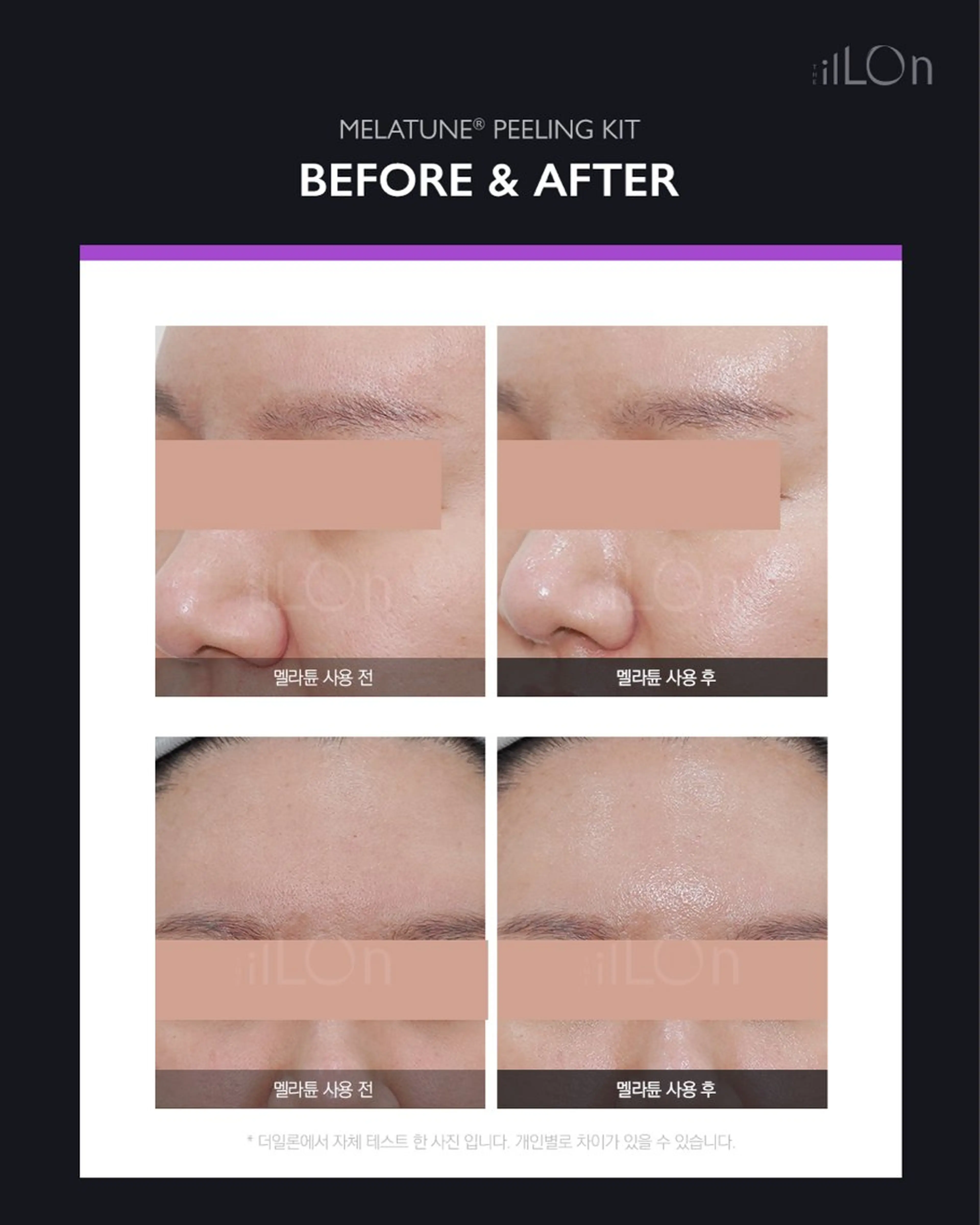 その他 Luca所属・Luca ﾙｶのエステ・リラクイメージ