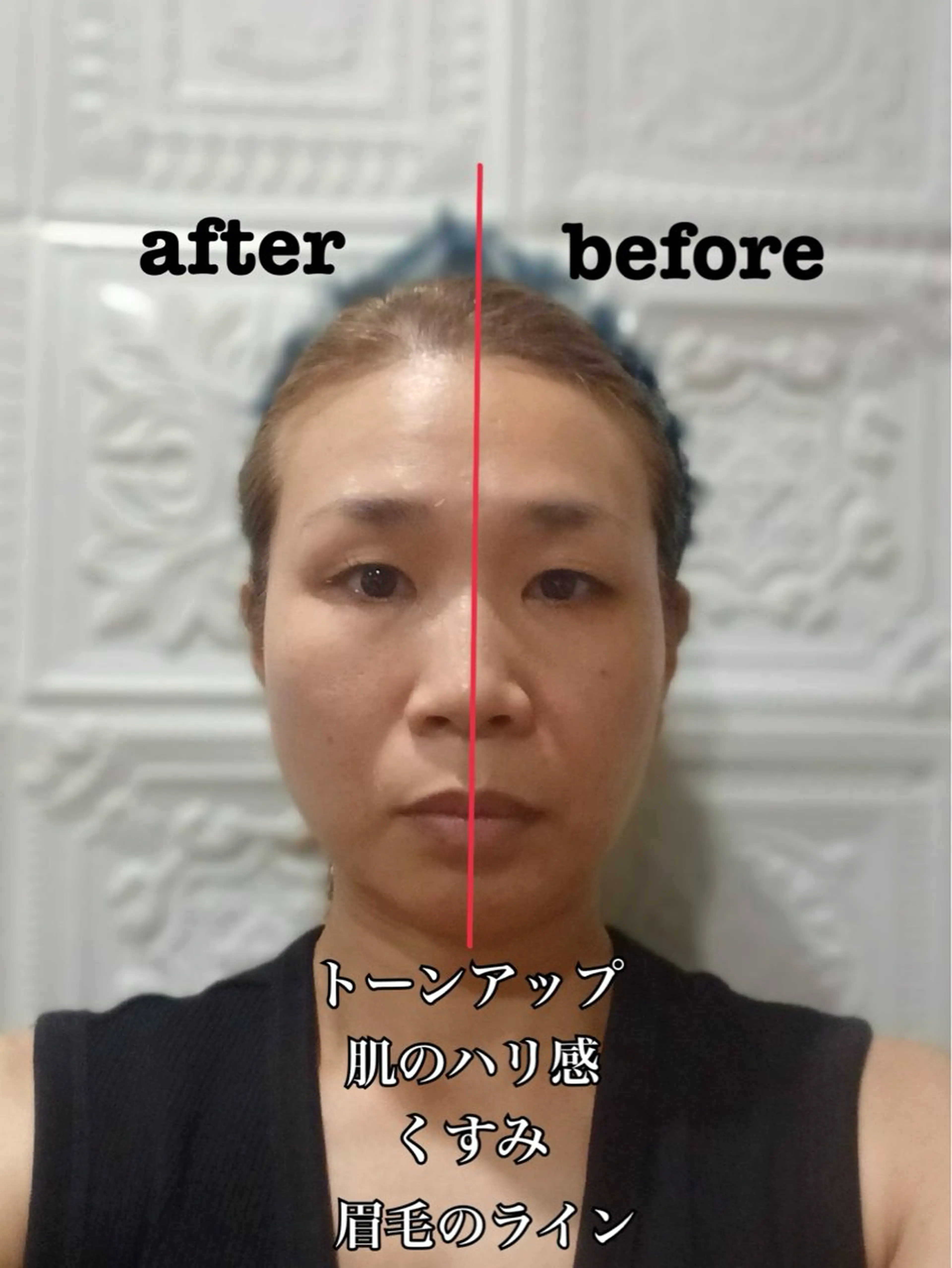 【人気No.1】✨フェイシャルワックス〈顔+首+デコルテ〉✨の写真