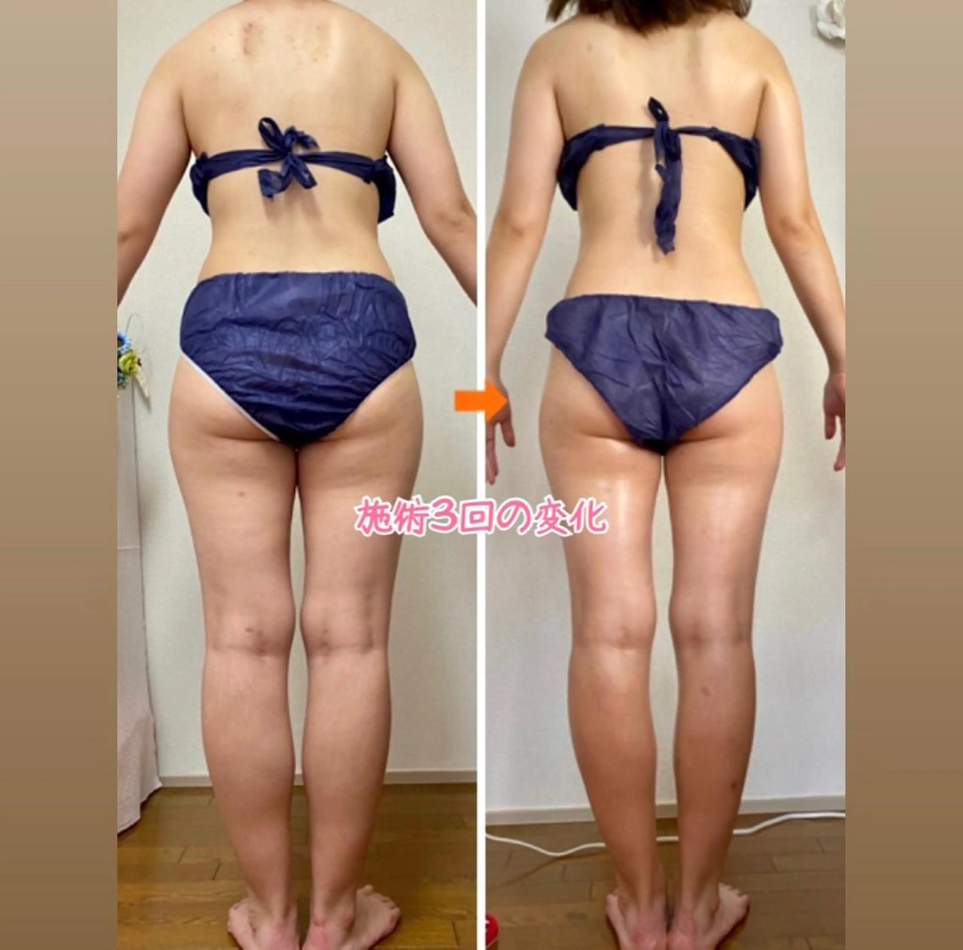 ショート カラー パーマ ヘアアレンジ メンズ キッズ ネイル マツエク・マツパ ‍痩身＆ボディ 結果出し🌟丹野のエステ・リラクイメージ